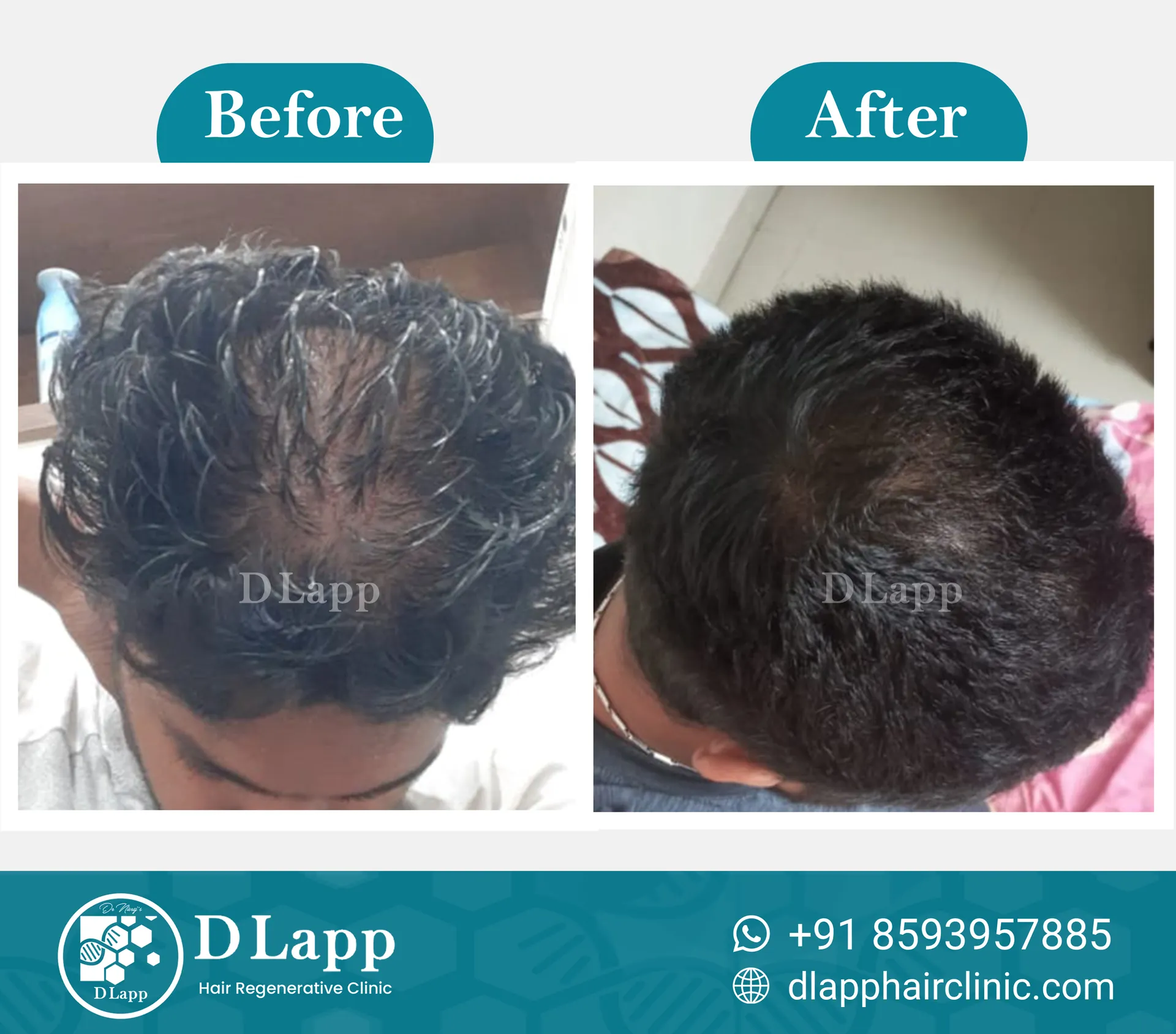 Before/After Medical Image