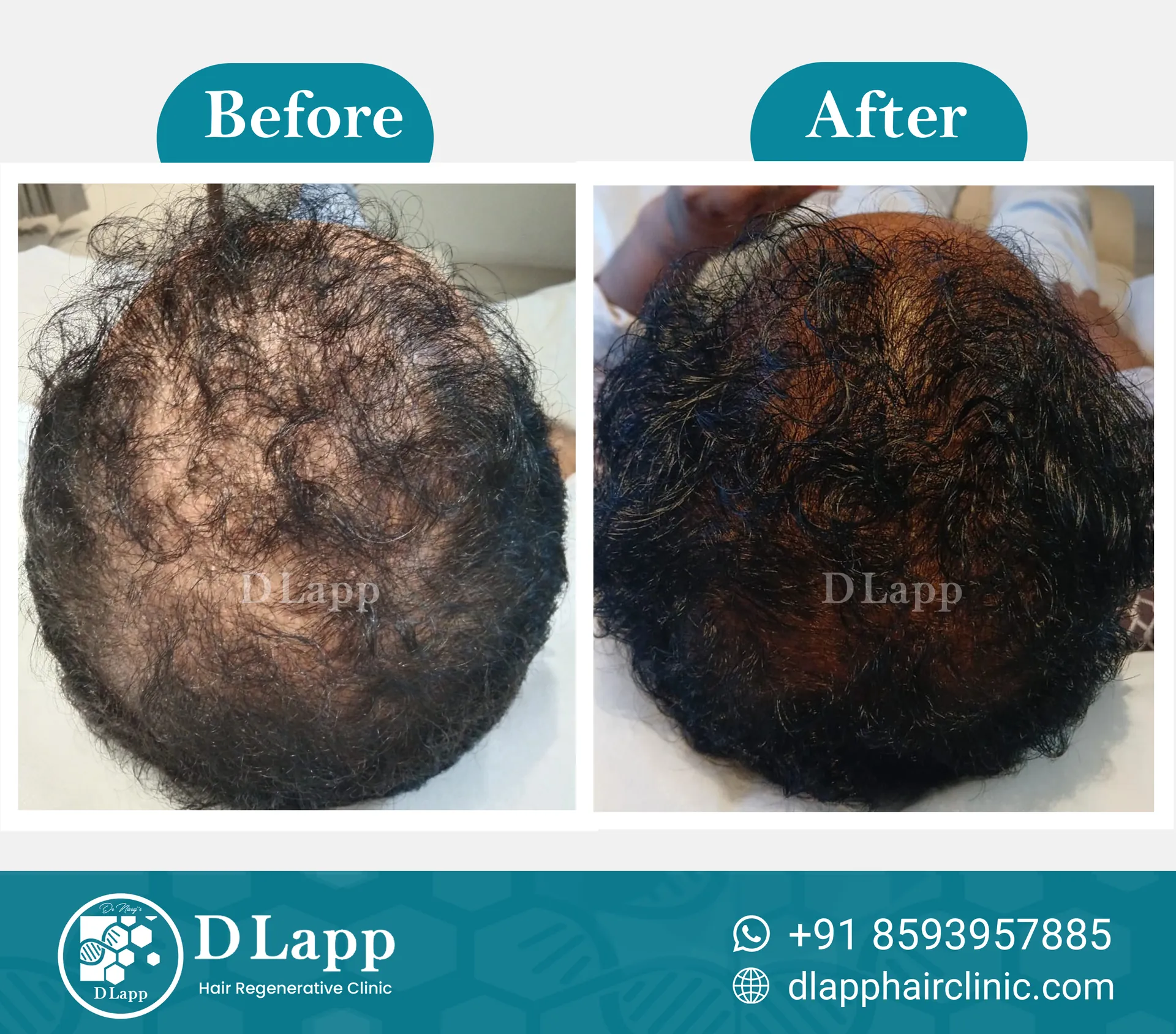 Before/After Medical Image