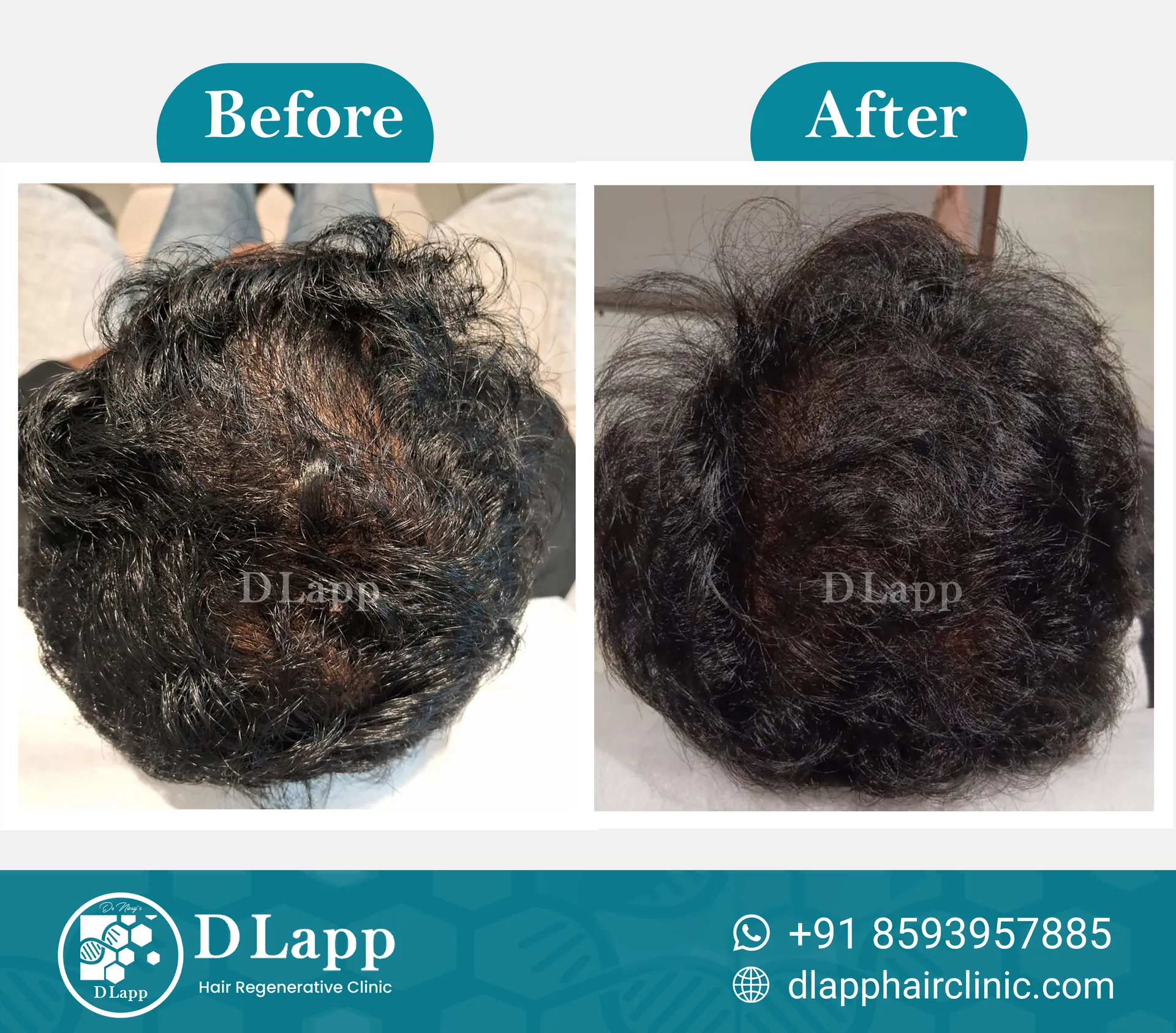 Before/After Medical Image