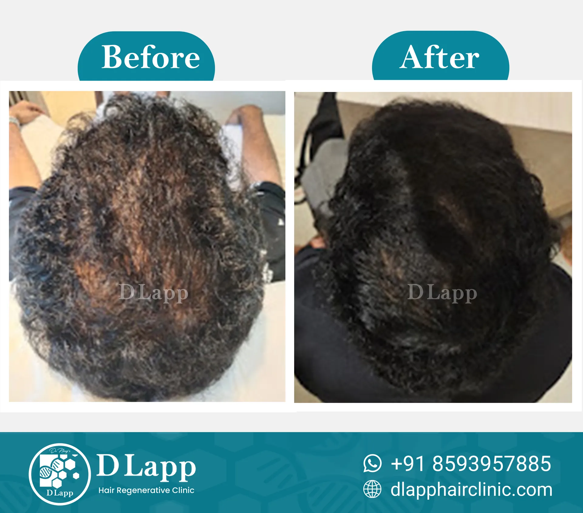Before/After Medical Image