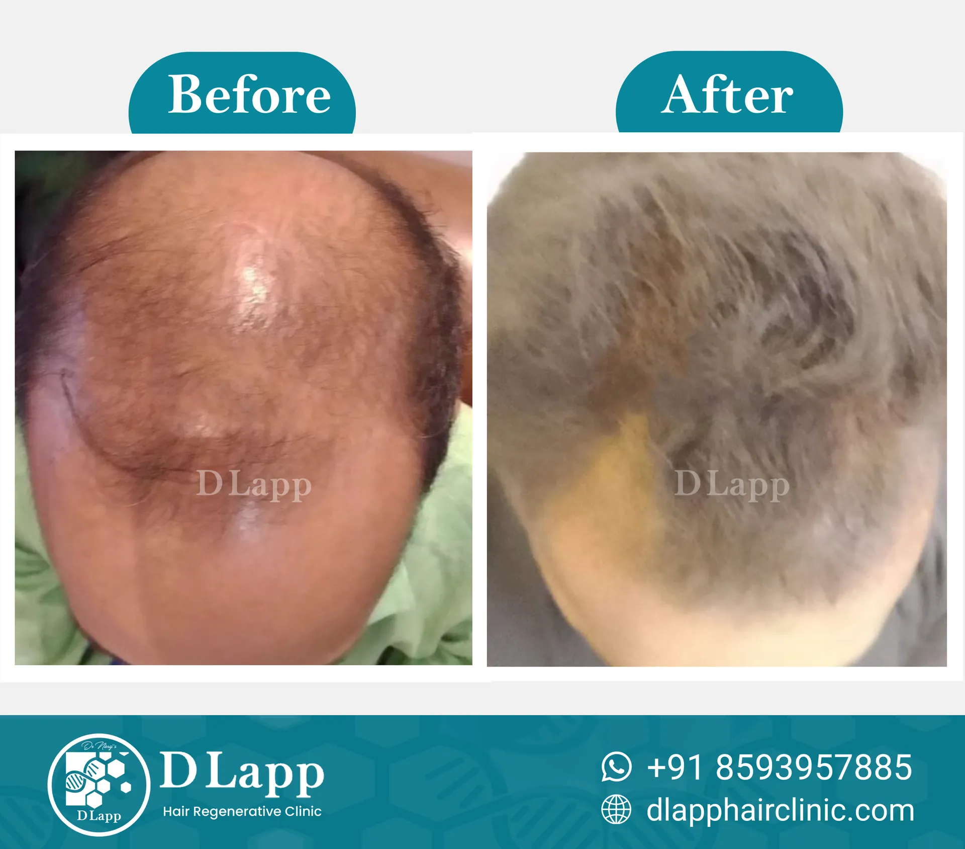 Before/After Medical Image