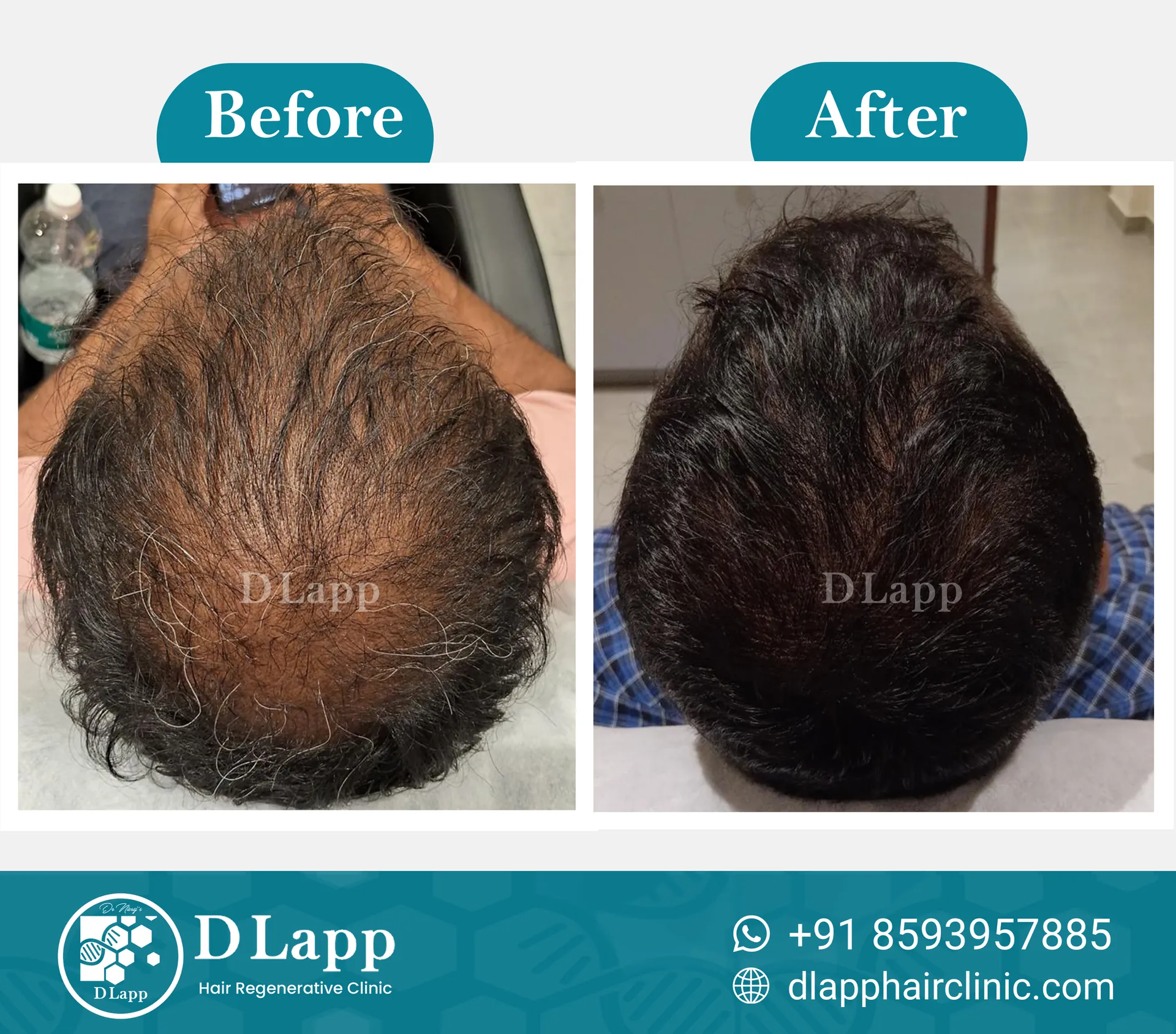 Before/After Medical Image
