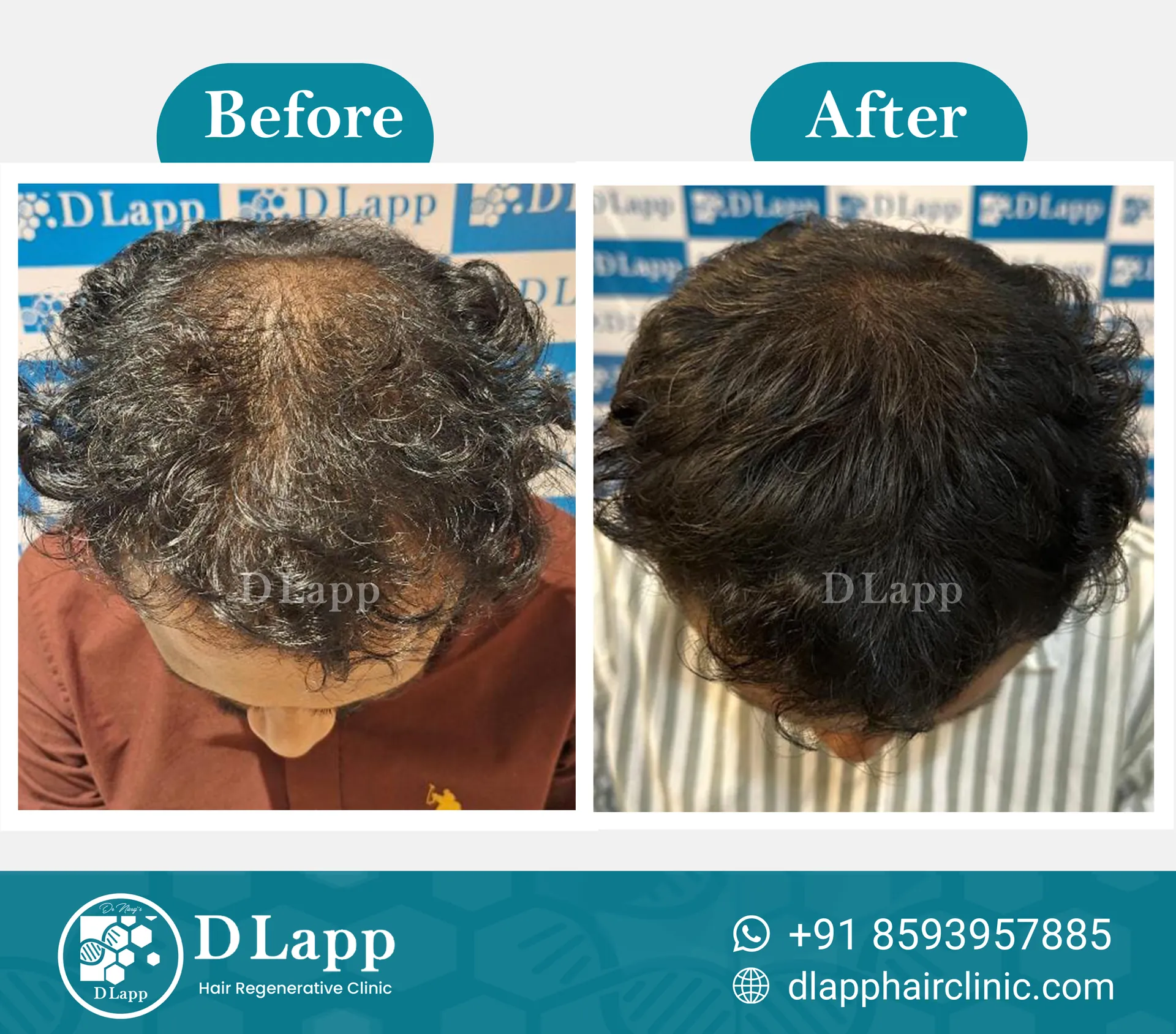 Before/After Medical Image