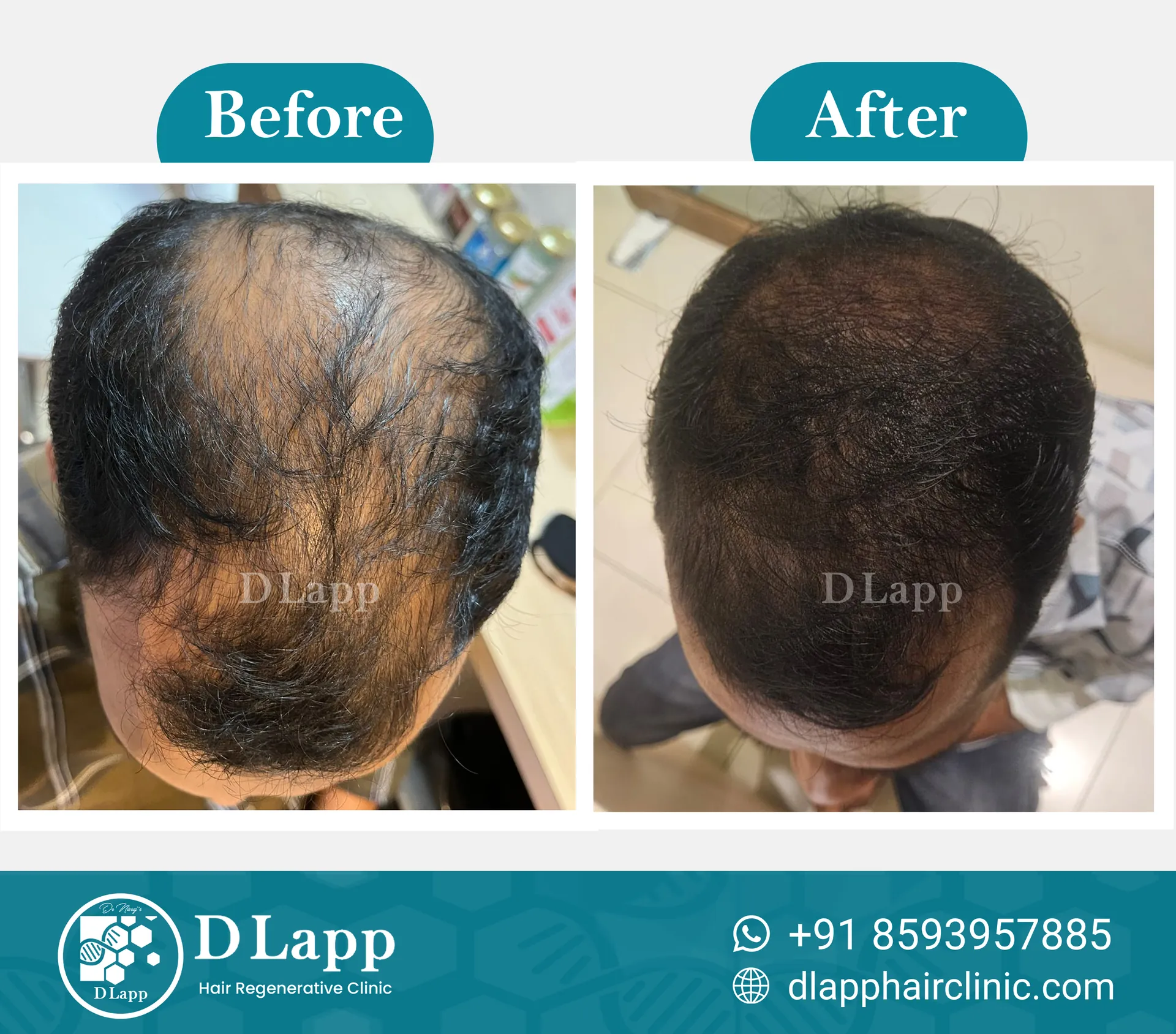 Before/After Medical Image