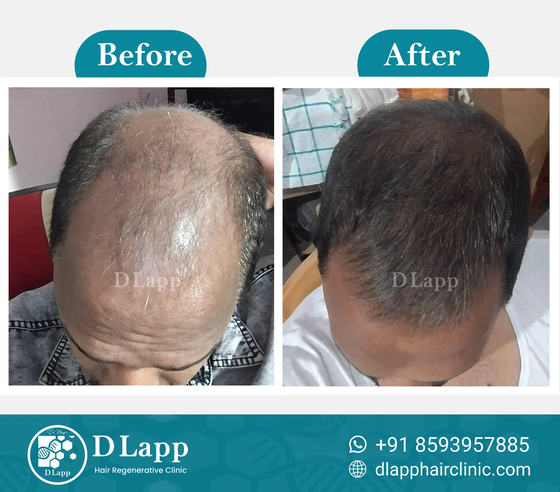 Before/After Medical Image