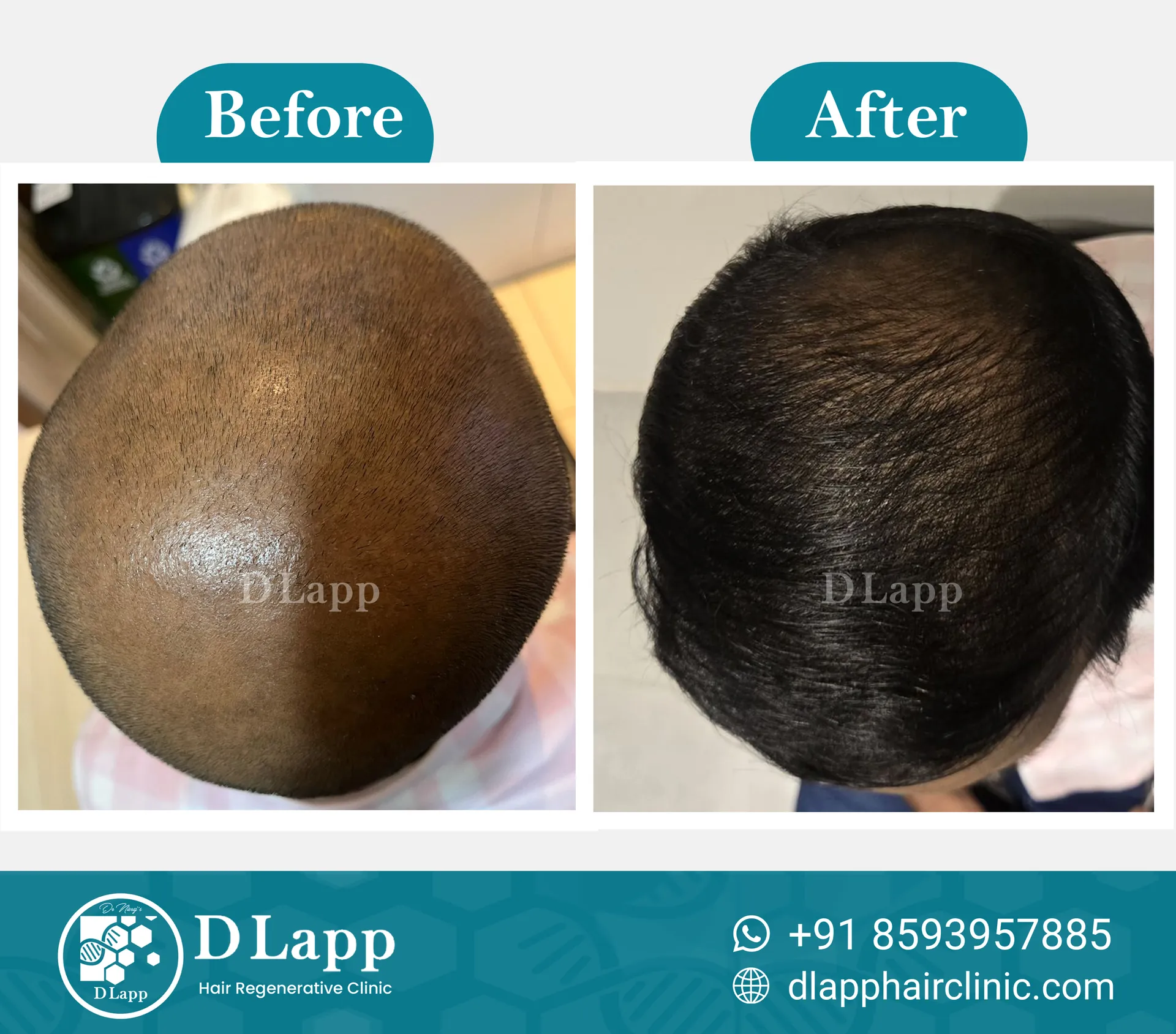 Before/After Medical Image