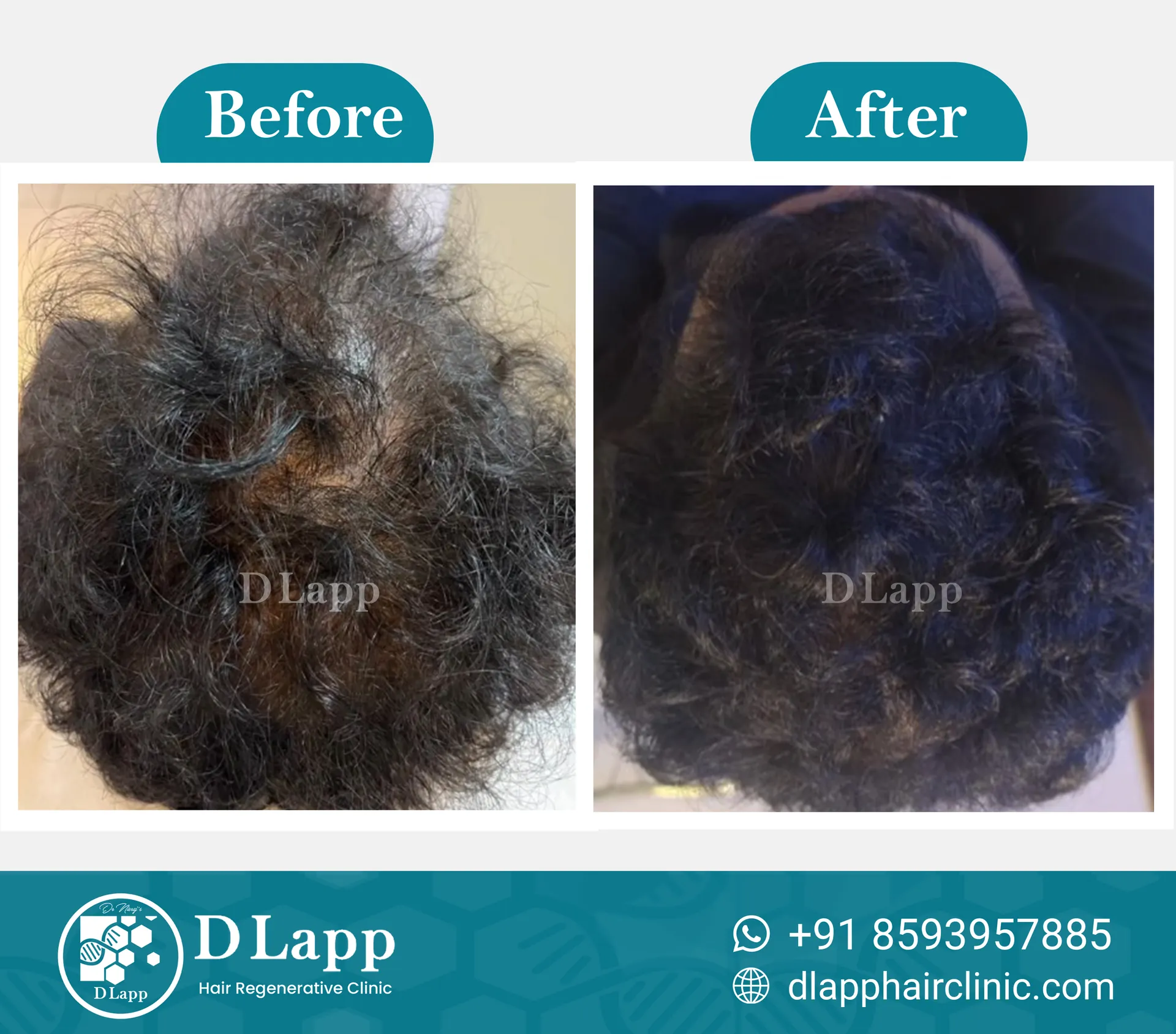 Before/After Medical Image