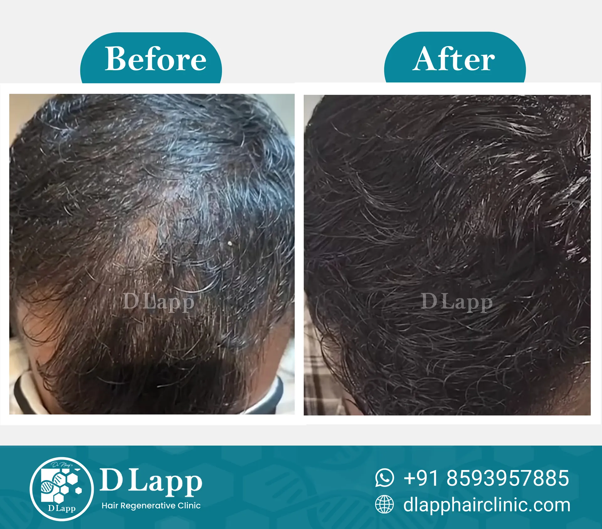 Before/After Medical Image