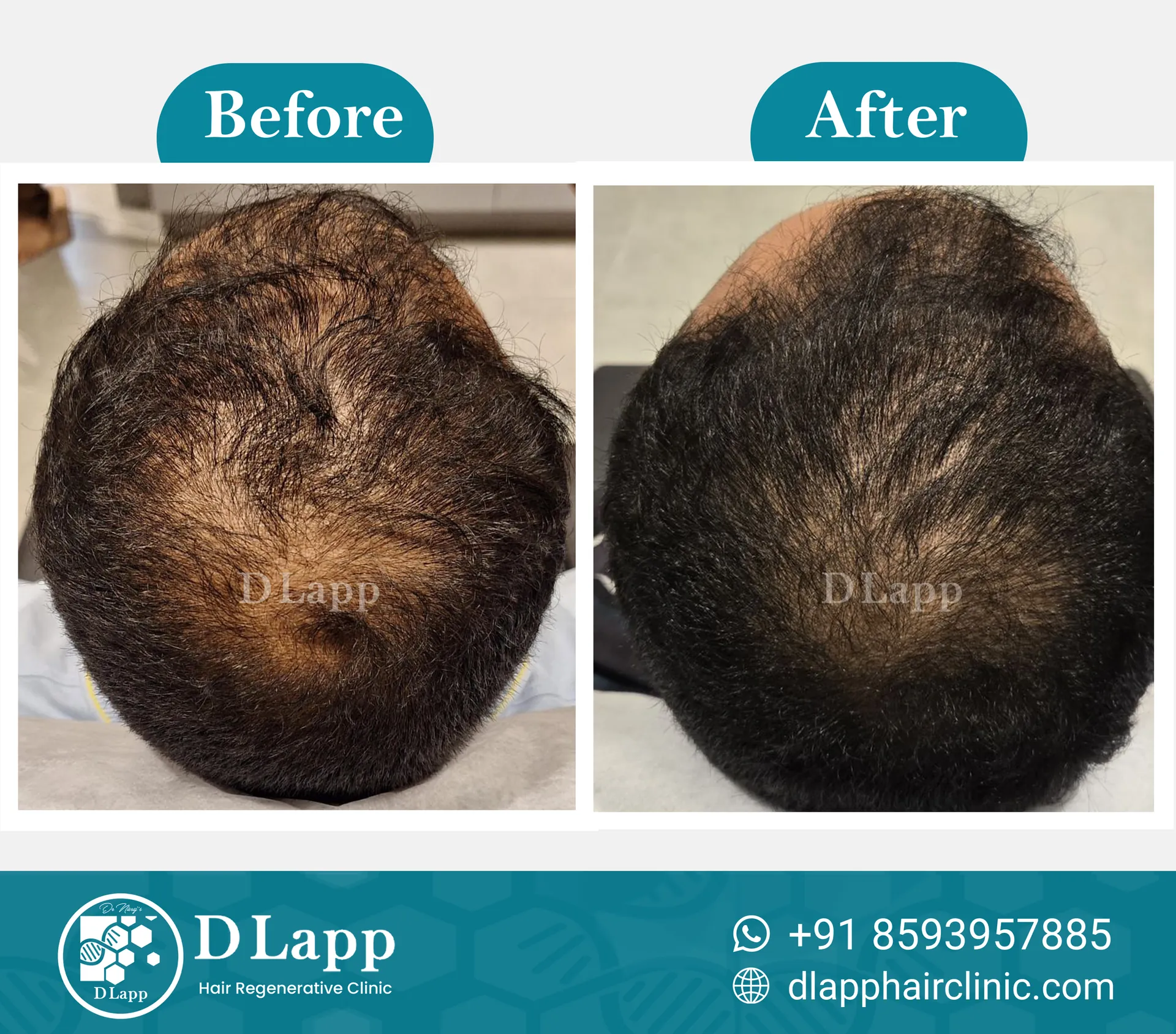 Before/After Medical Image