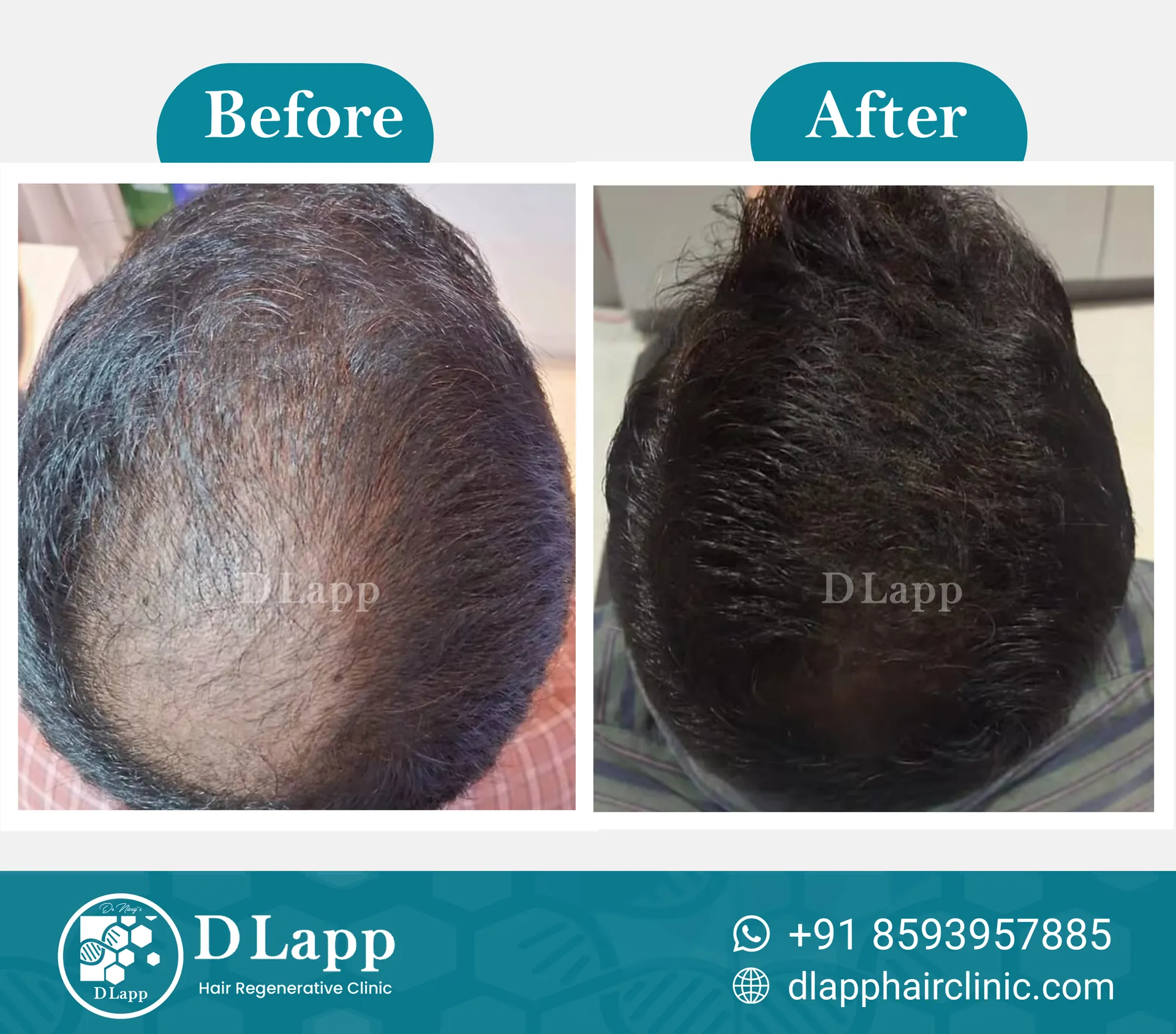 Before/After Medical Image