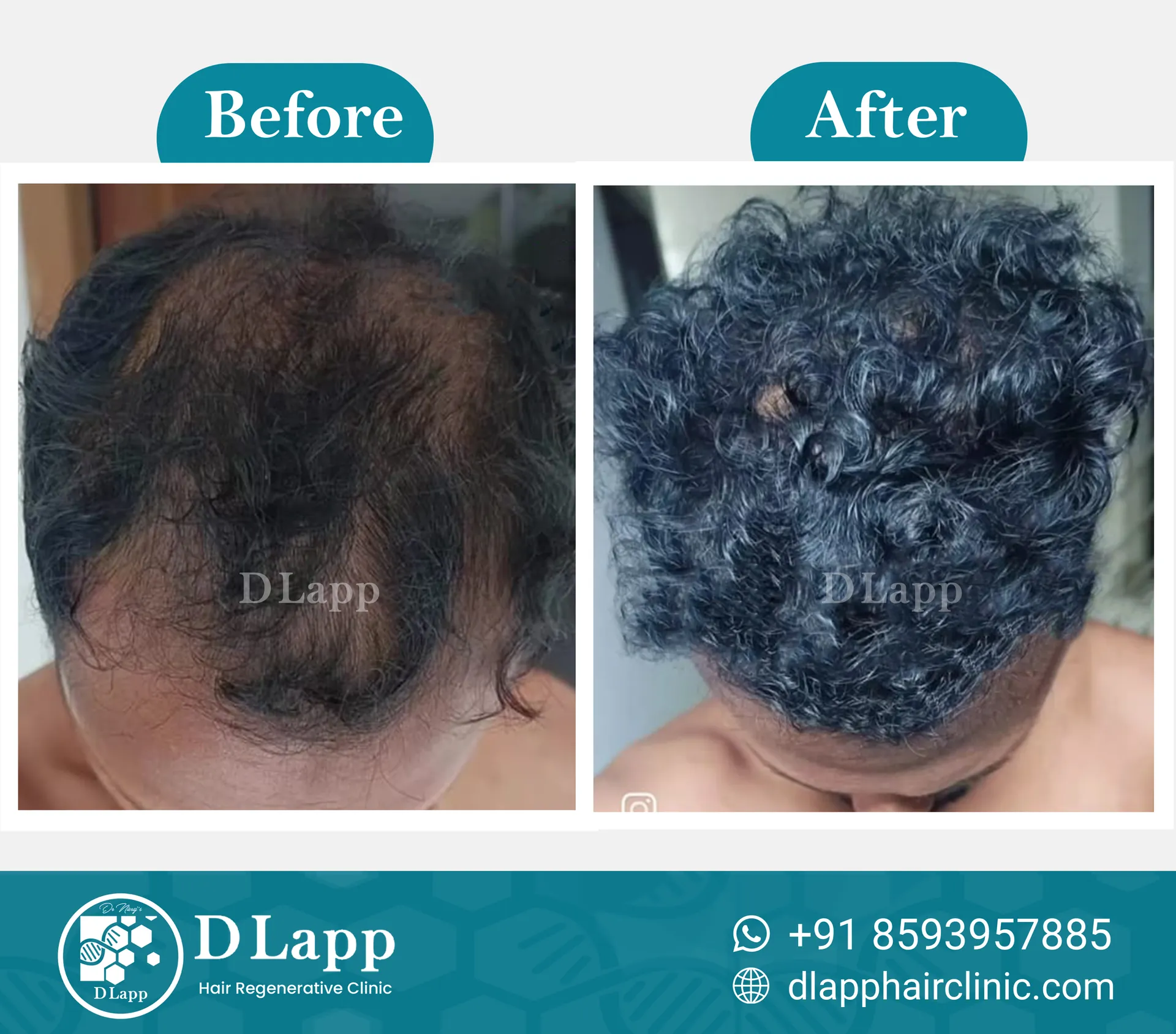 Before/After Medical Image