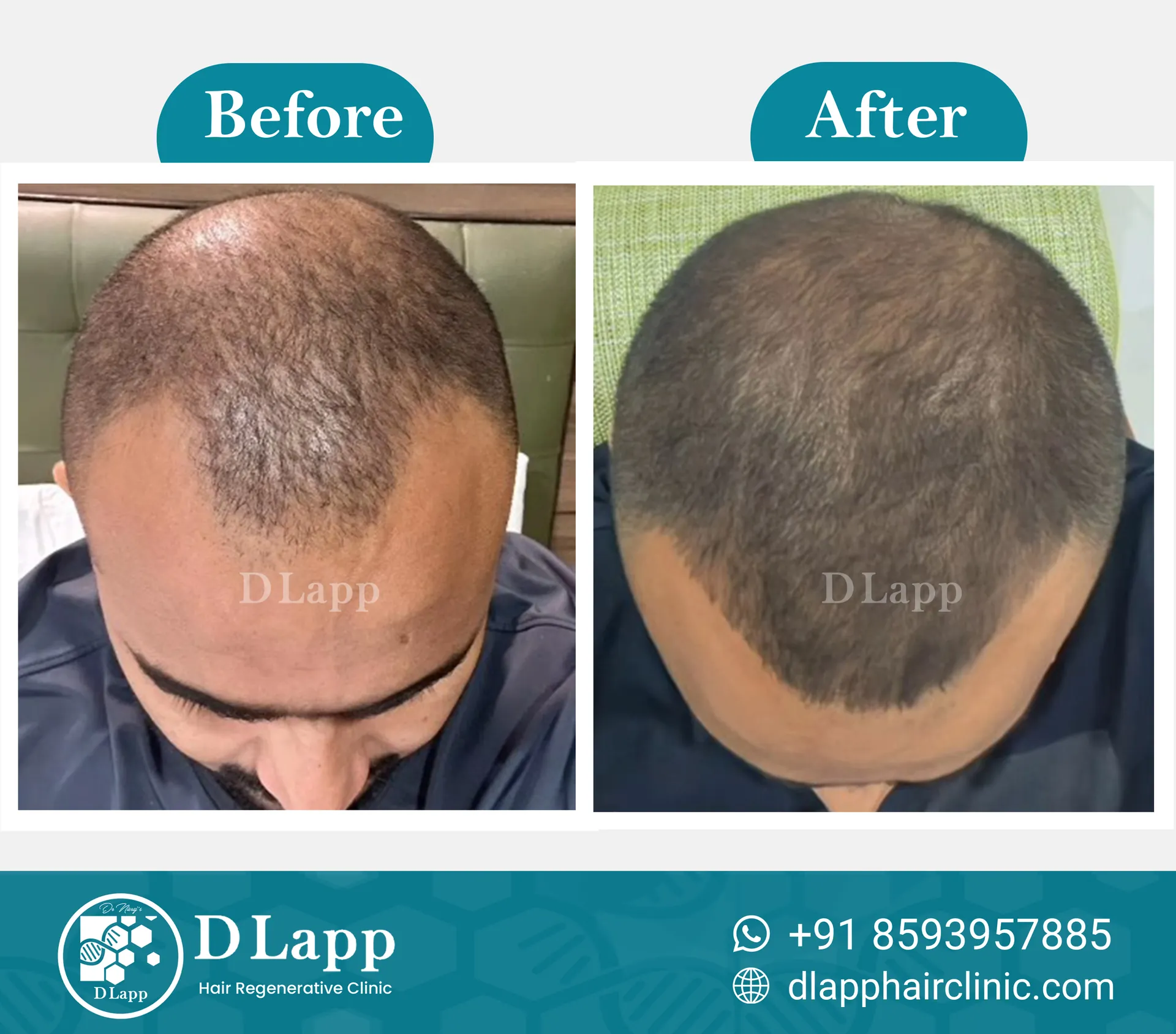 Before/After Medical Image