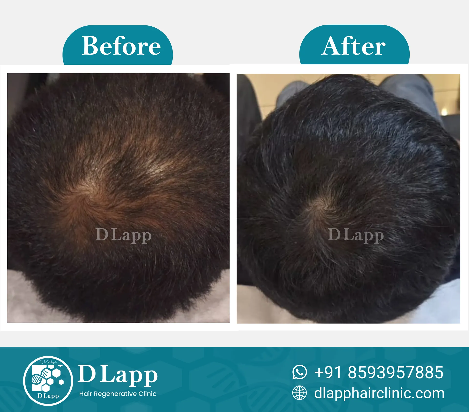 Before/After Medical Image