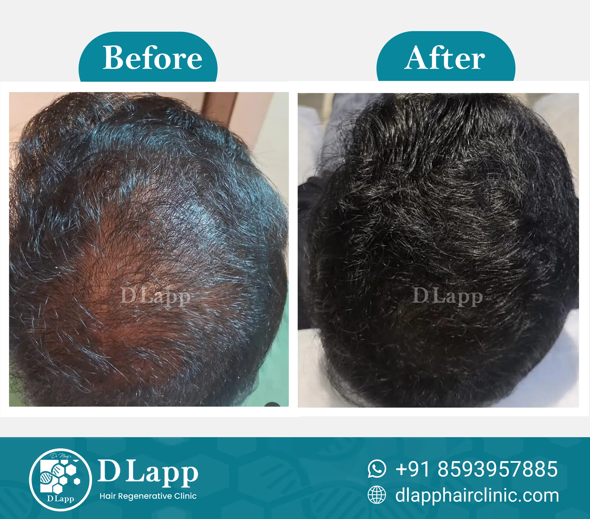 Before/After Medical Image