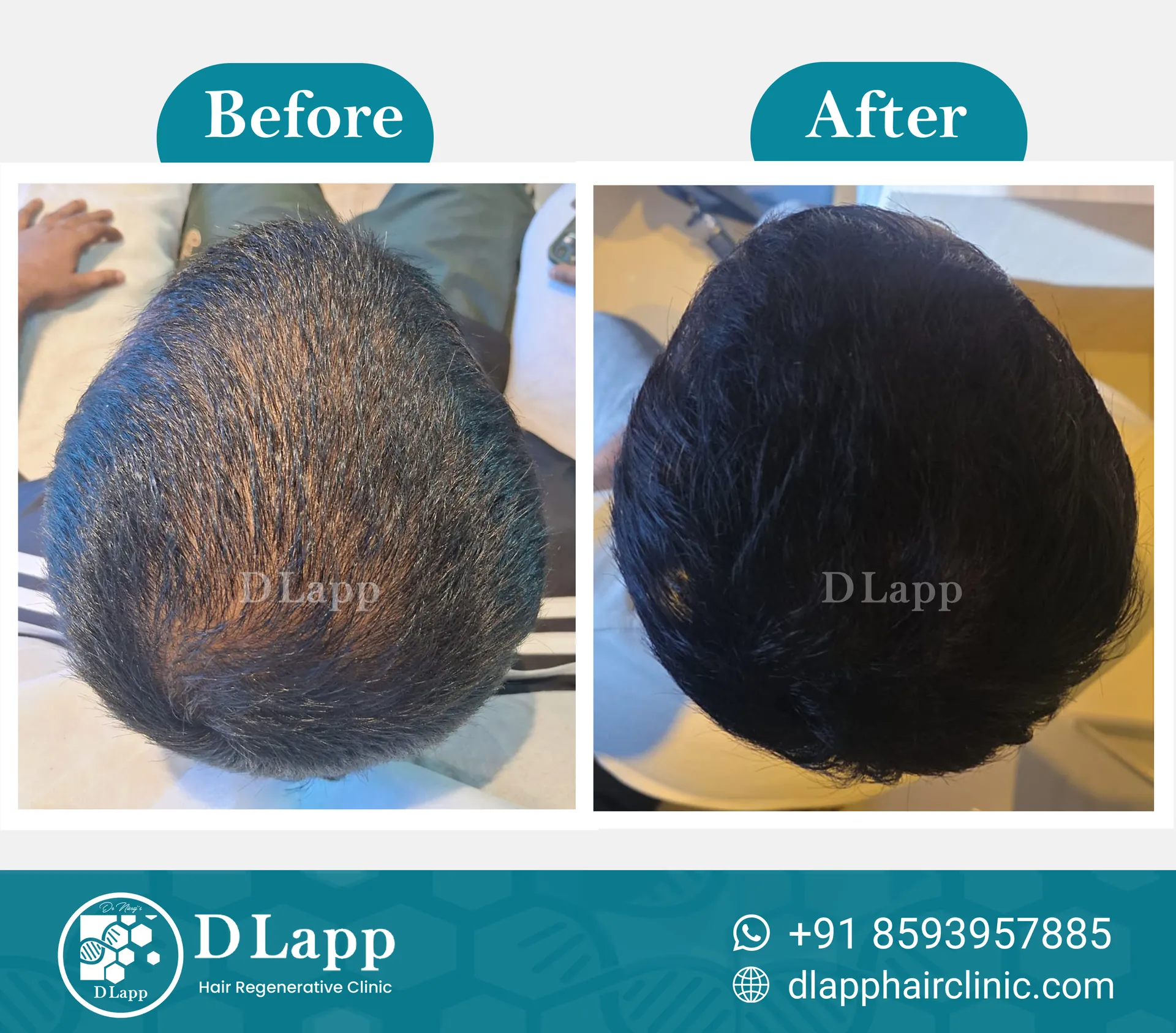 Before/After Medical Image
