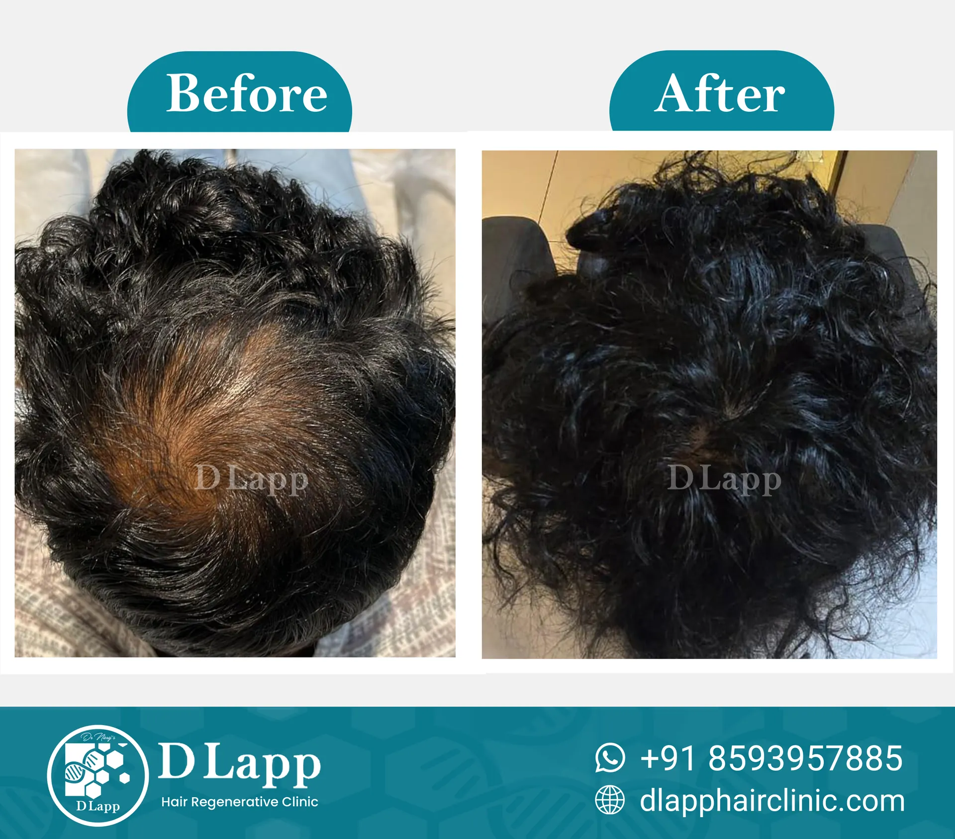 Before/After Medical Image