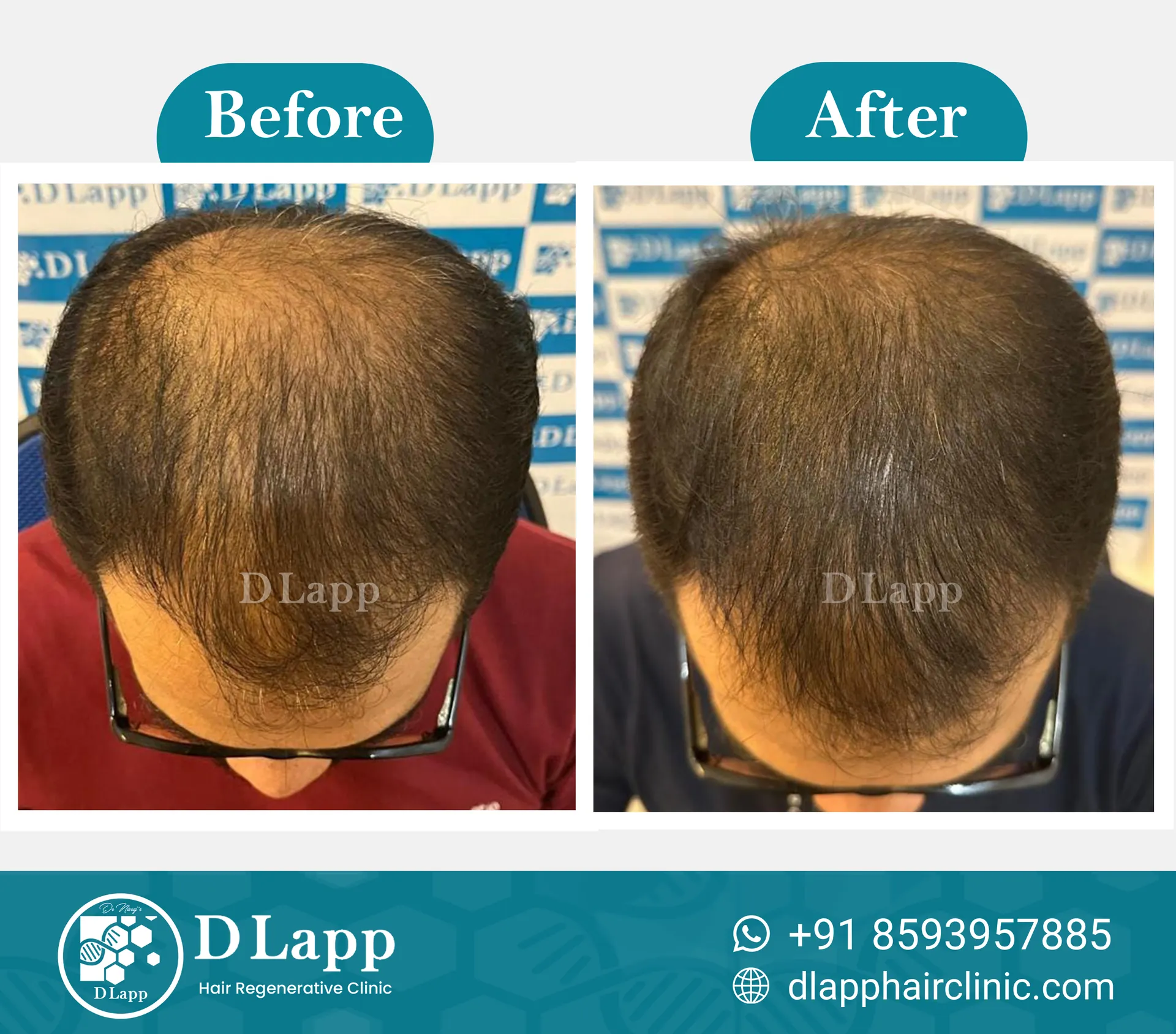 Before/After Medical Image