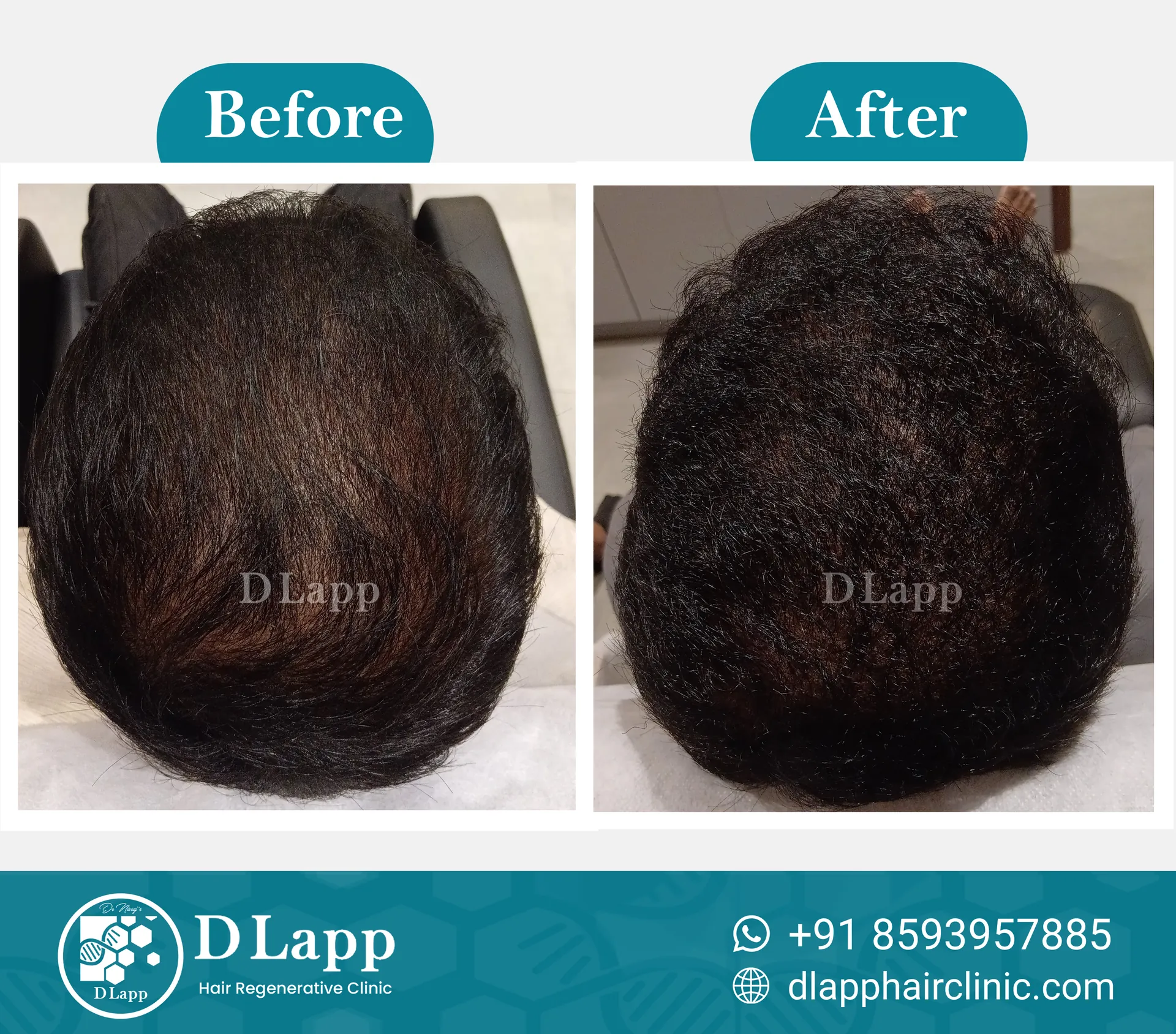Before/After Medical Image