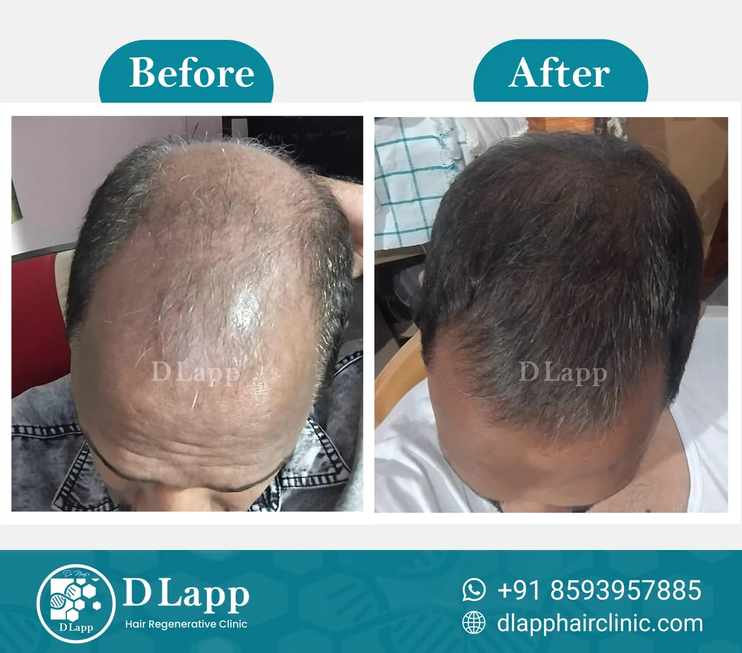 Before/After Medical Image