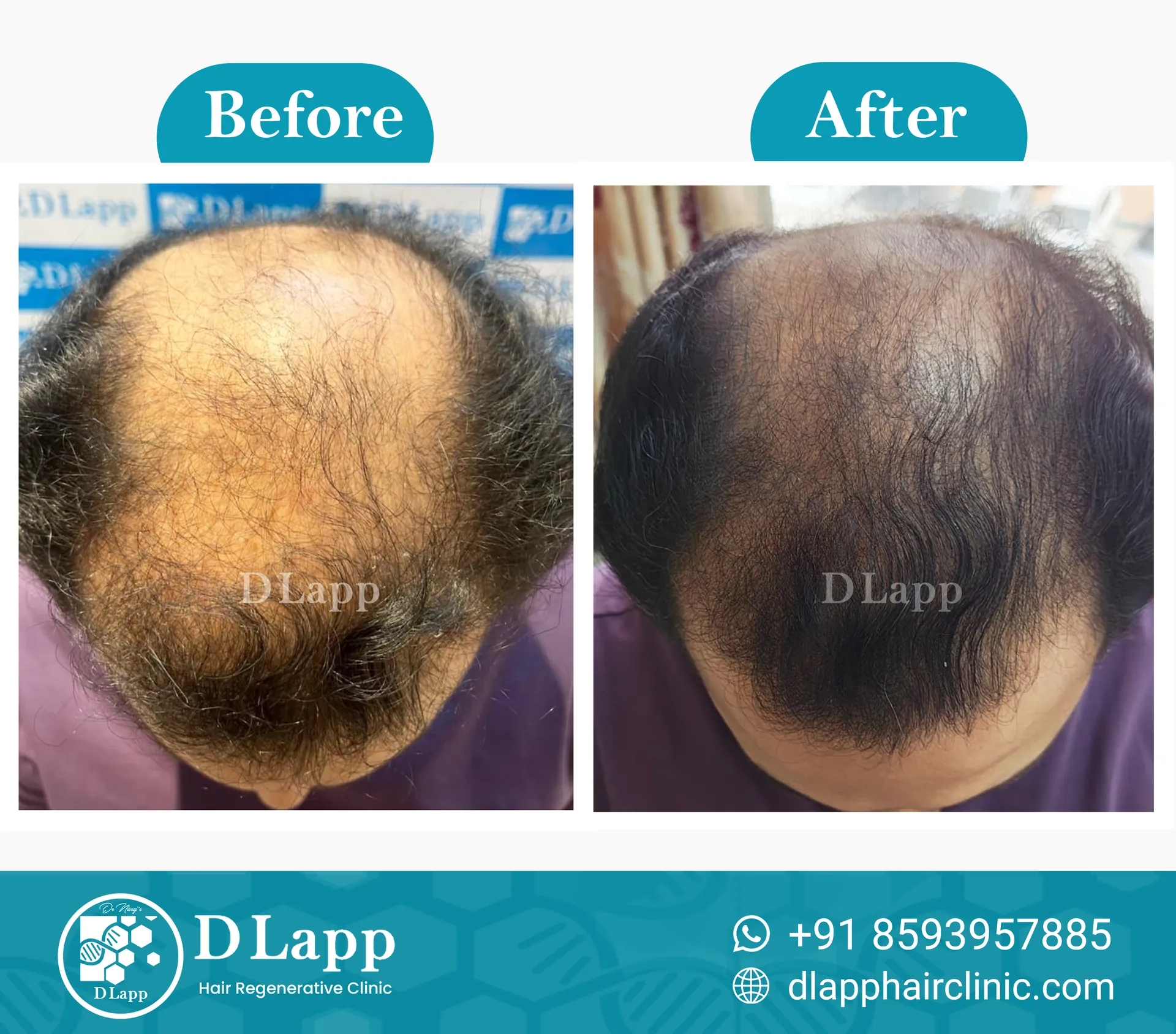 Before/After Medical Image