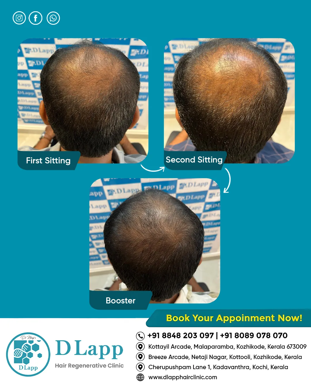 Before/After Medical Image