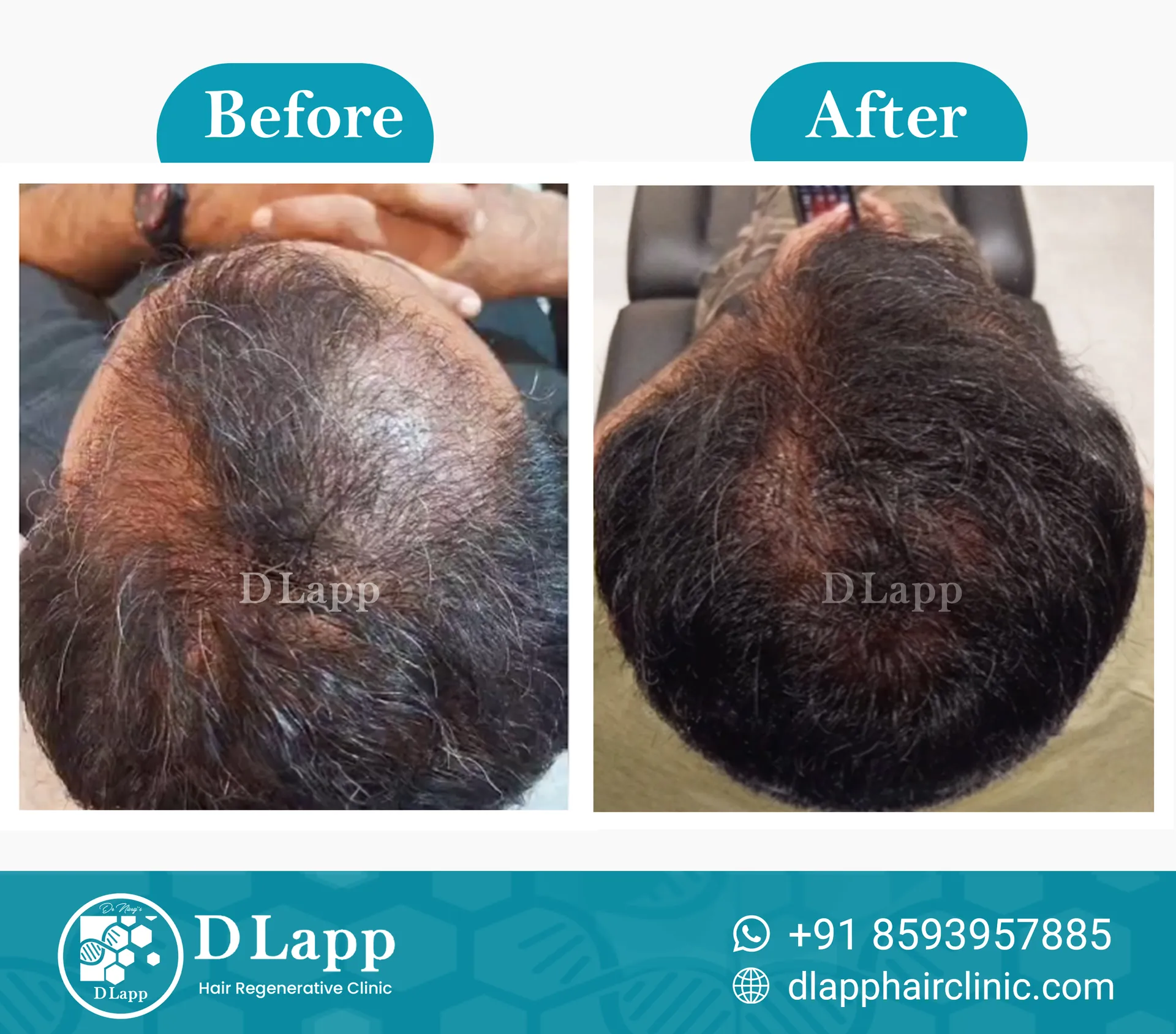 Before/After Medical Image
