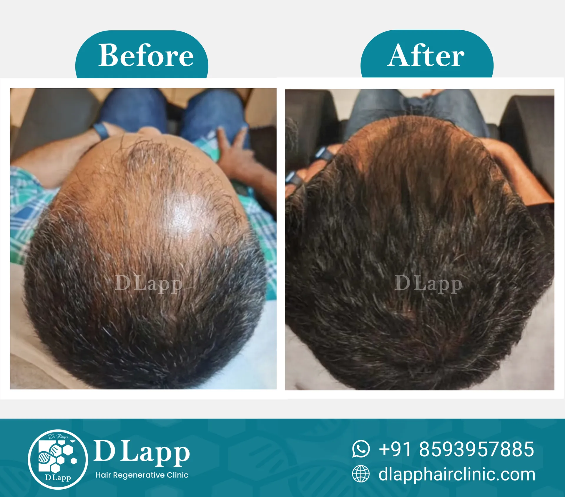 Before/After Medical Image