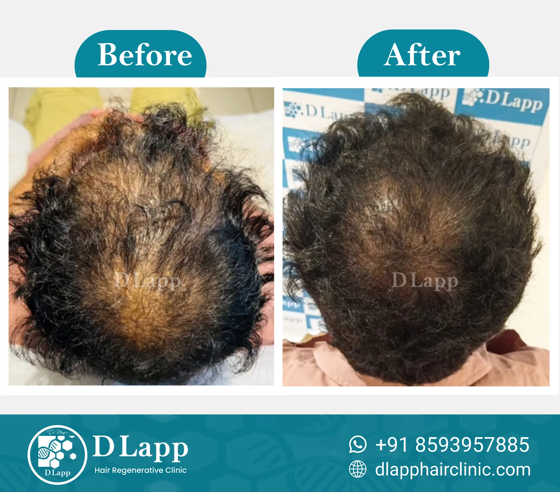Before/After Medical Image