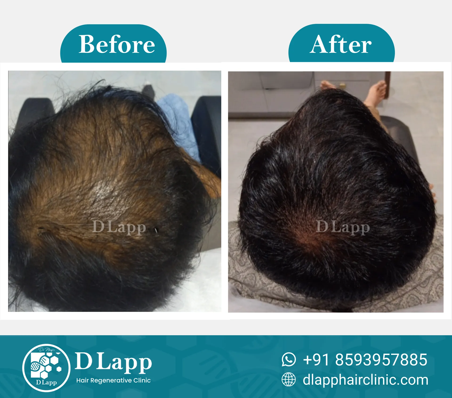 Before/After Medical Image