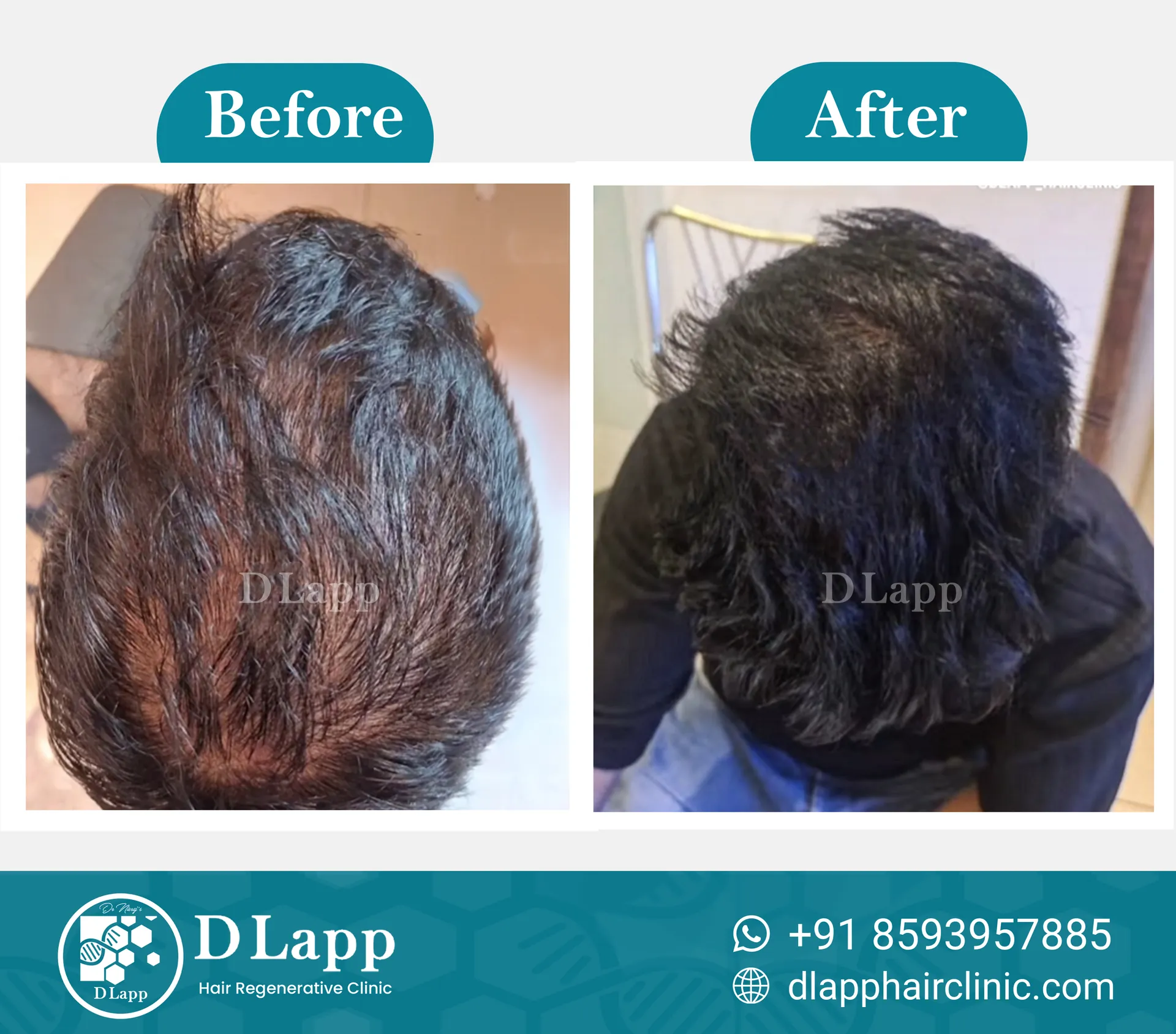 Before/After Medical Image