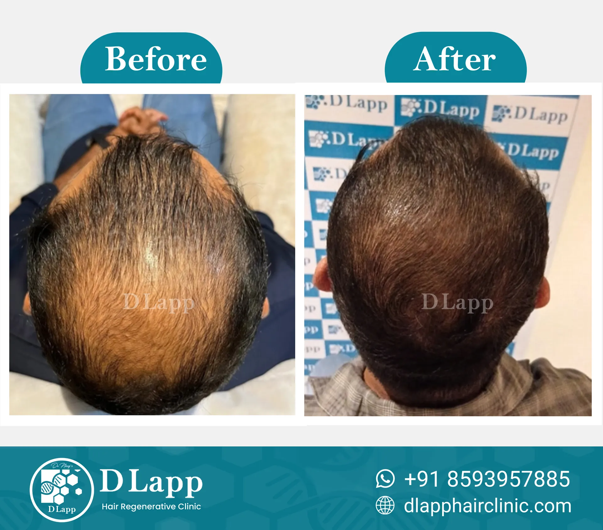 Before/After Medical Image