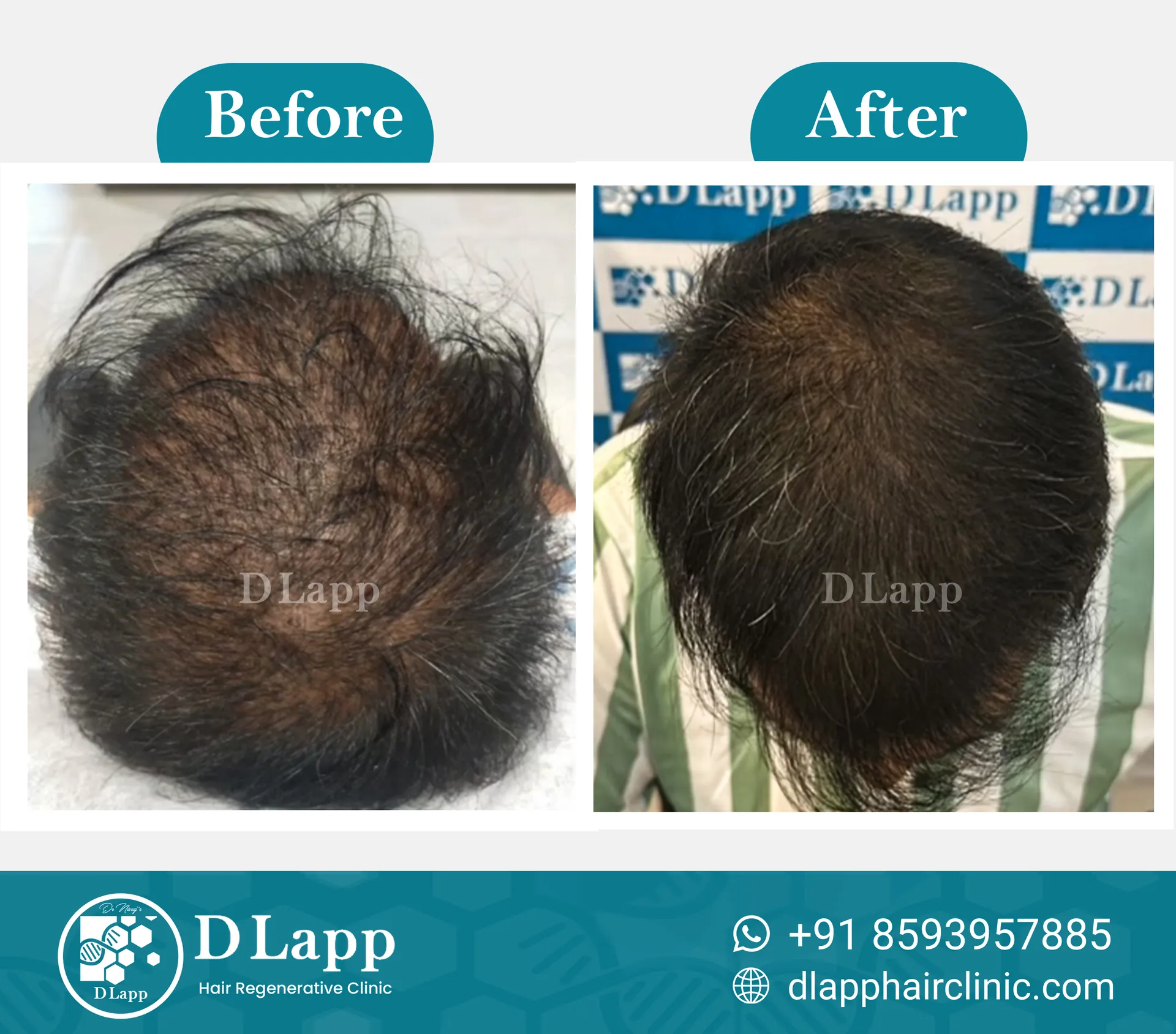 Before/After Medical Image