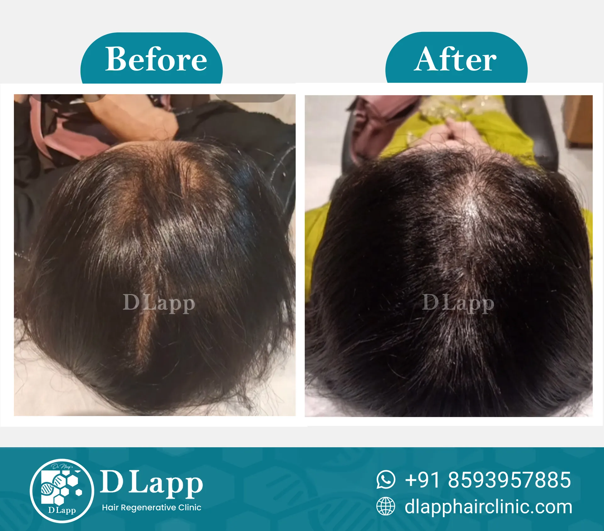 Before/After Medical Image