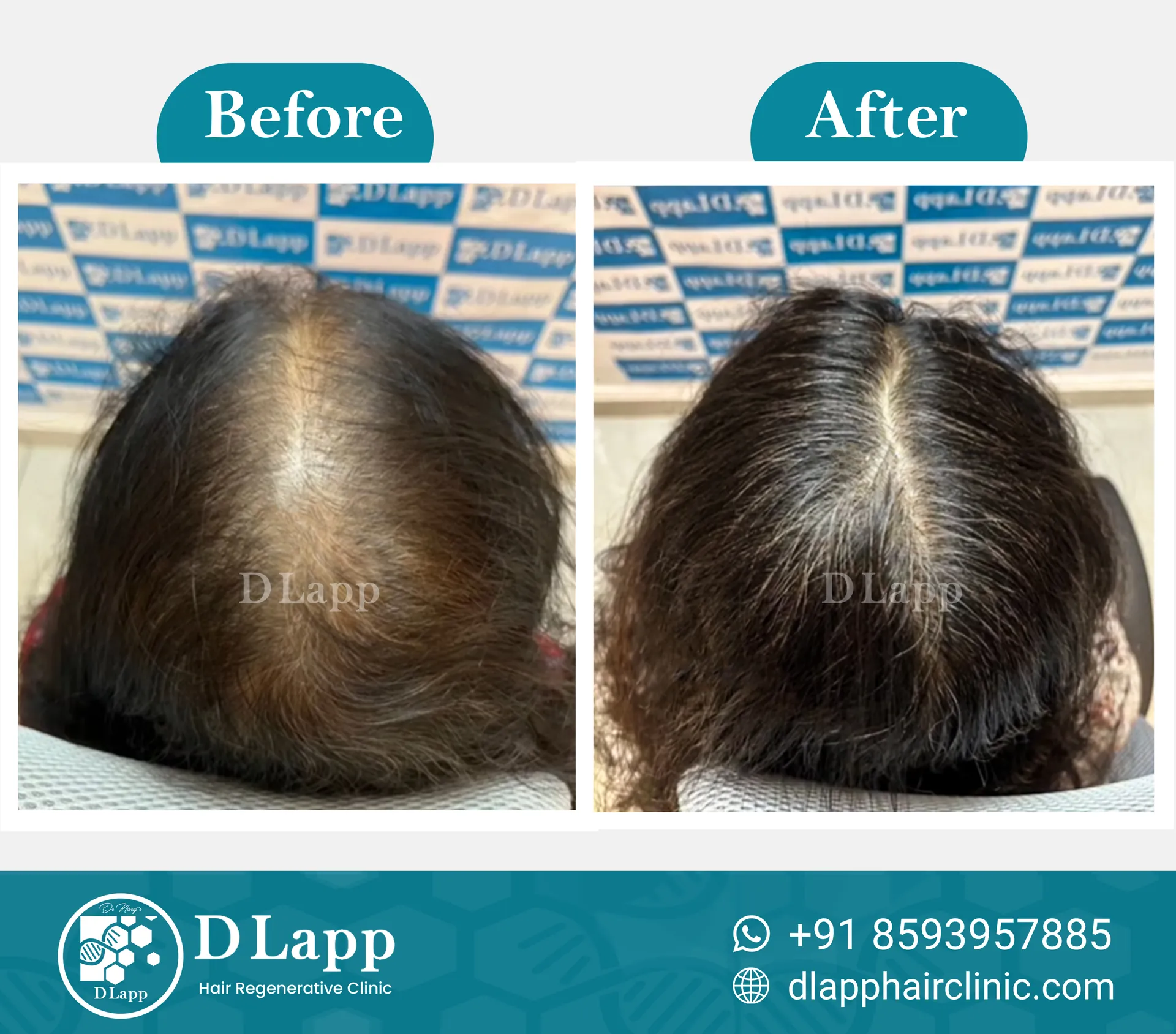 Before/After Medical Image