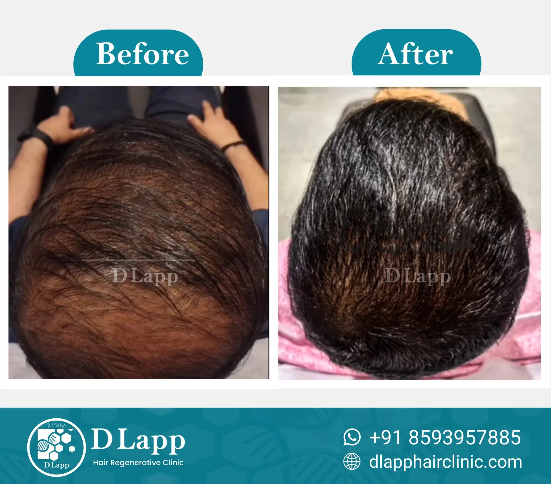 Before/After Medical Image