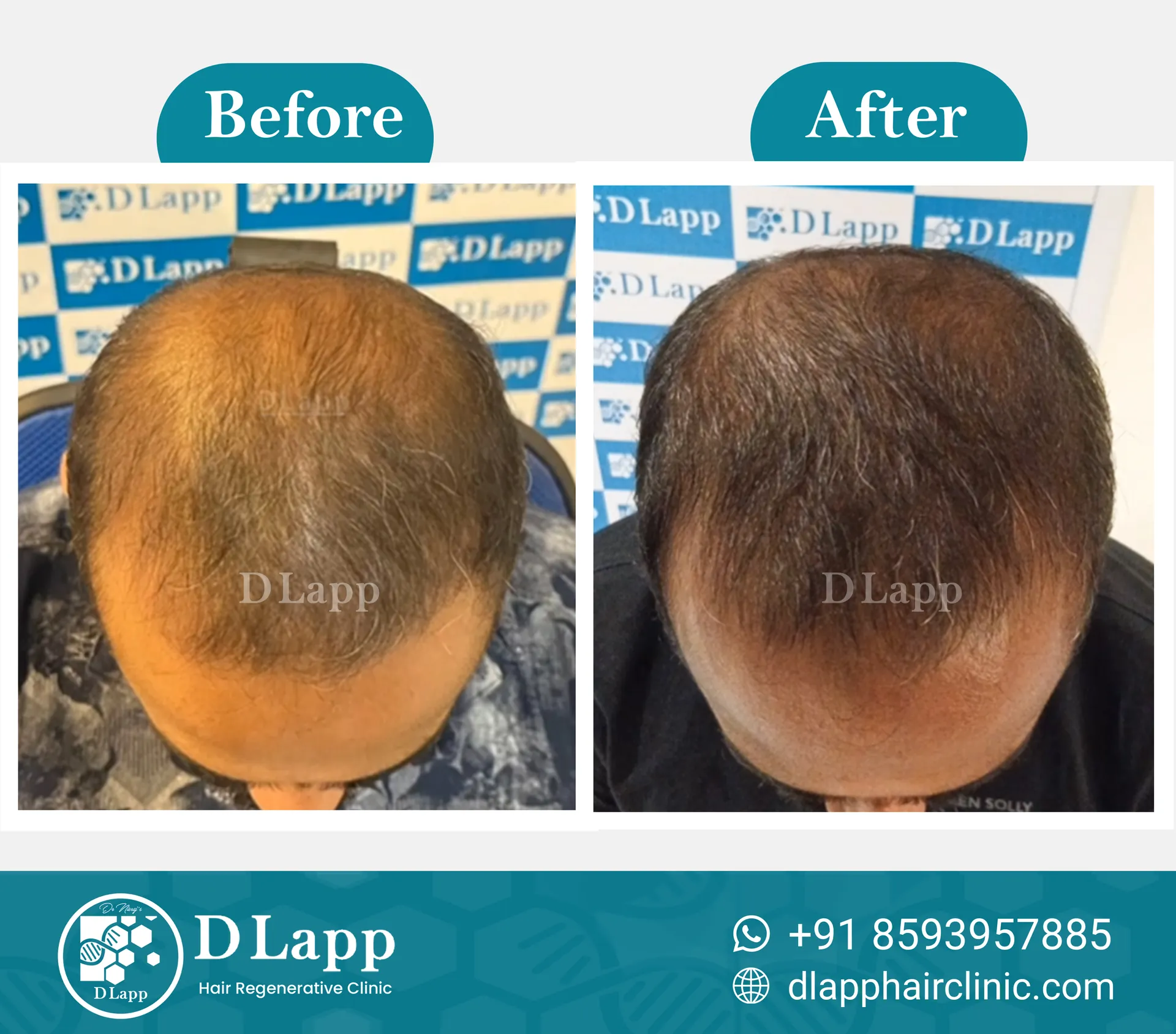 Before/After Medical Image