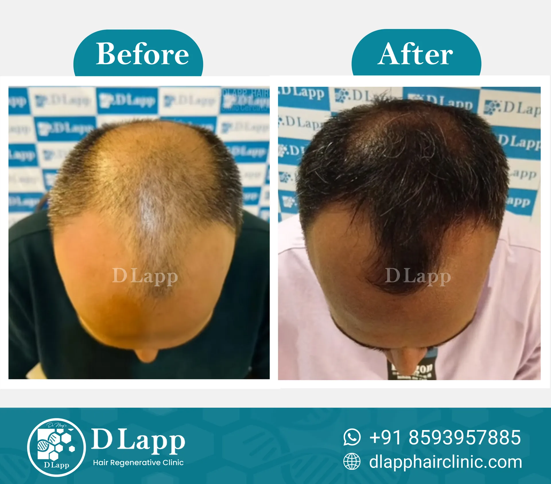 Before/After Medical Image