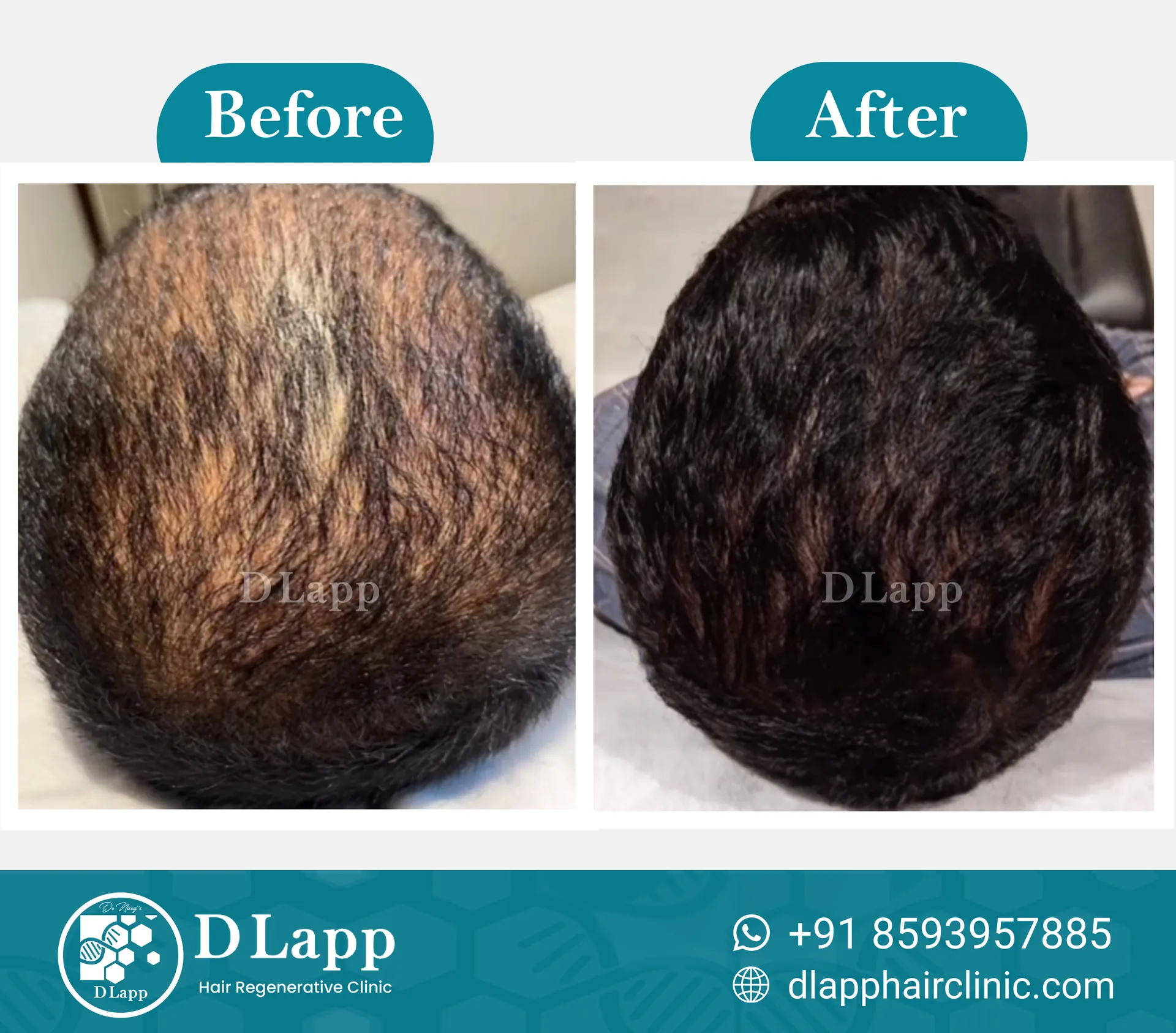 Before/After Medical Image