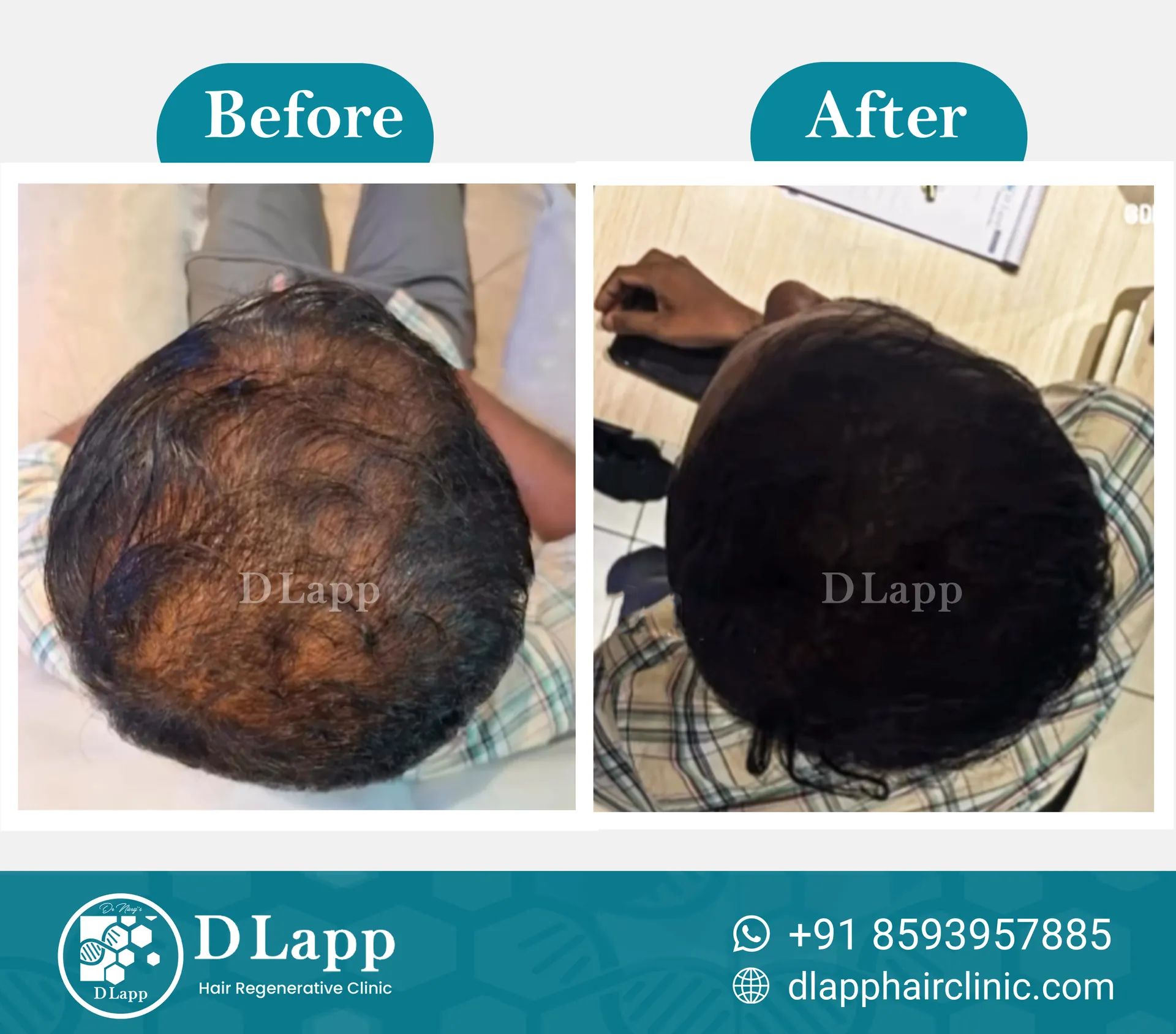 Before/After Medical Image