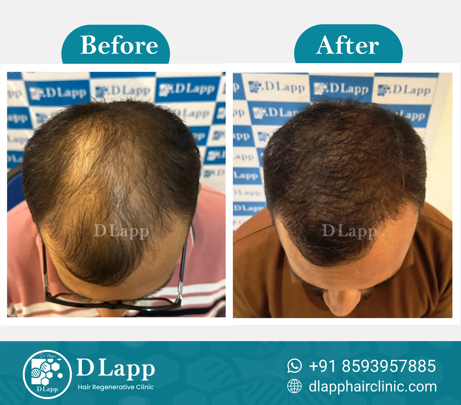 Before/After Medical Image