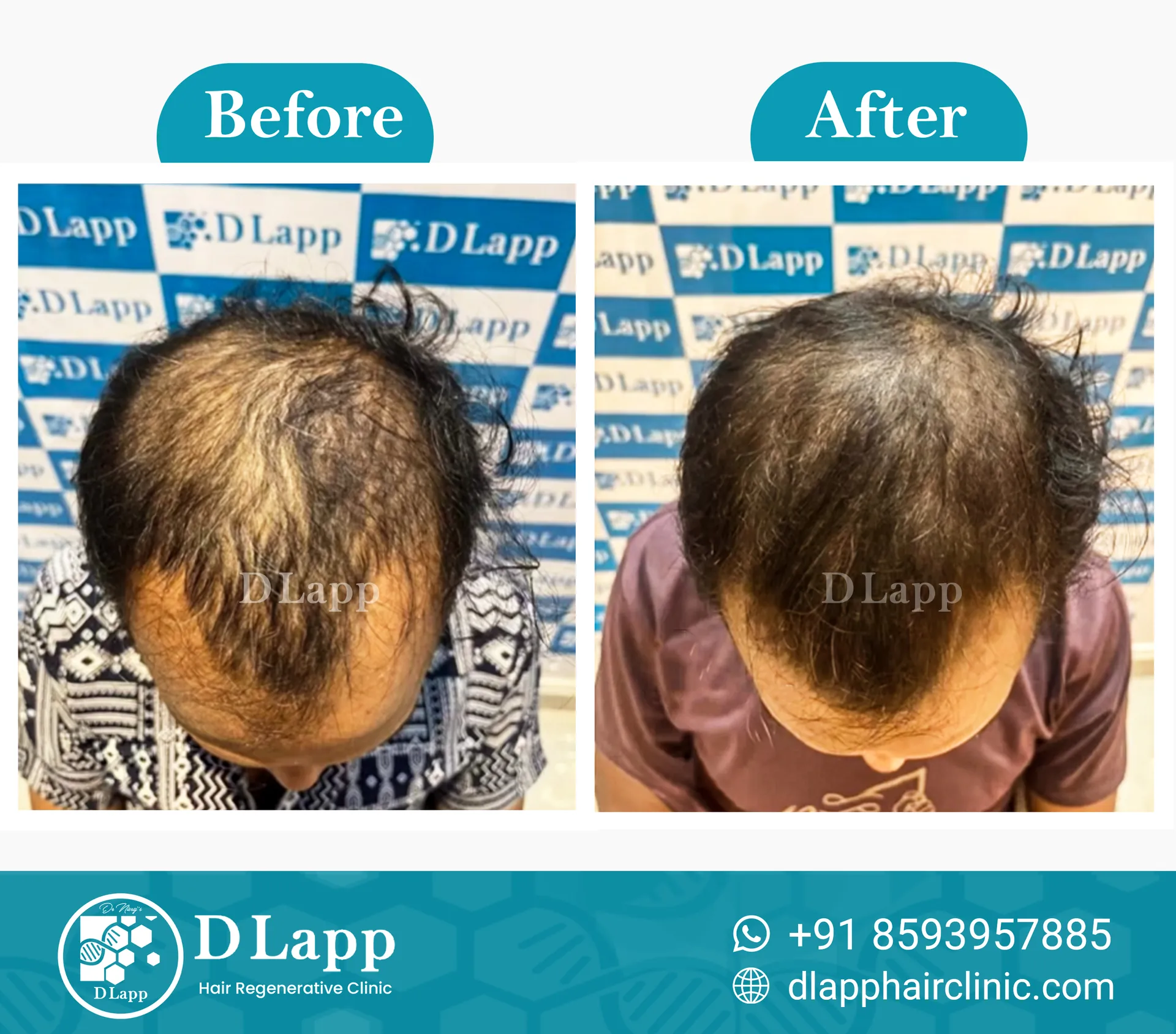 Before/After Medical Image
