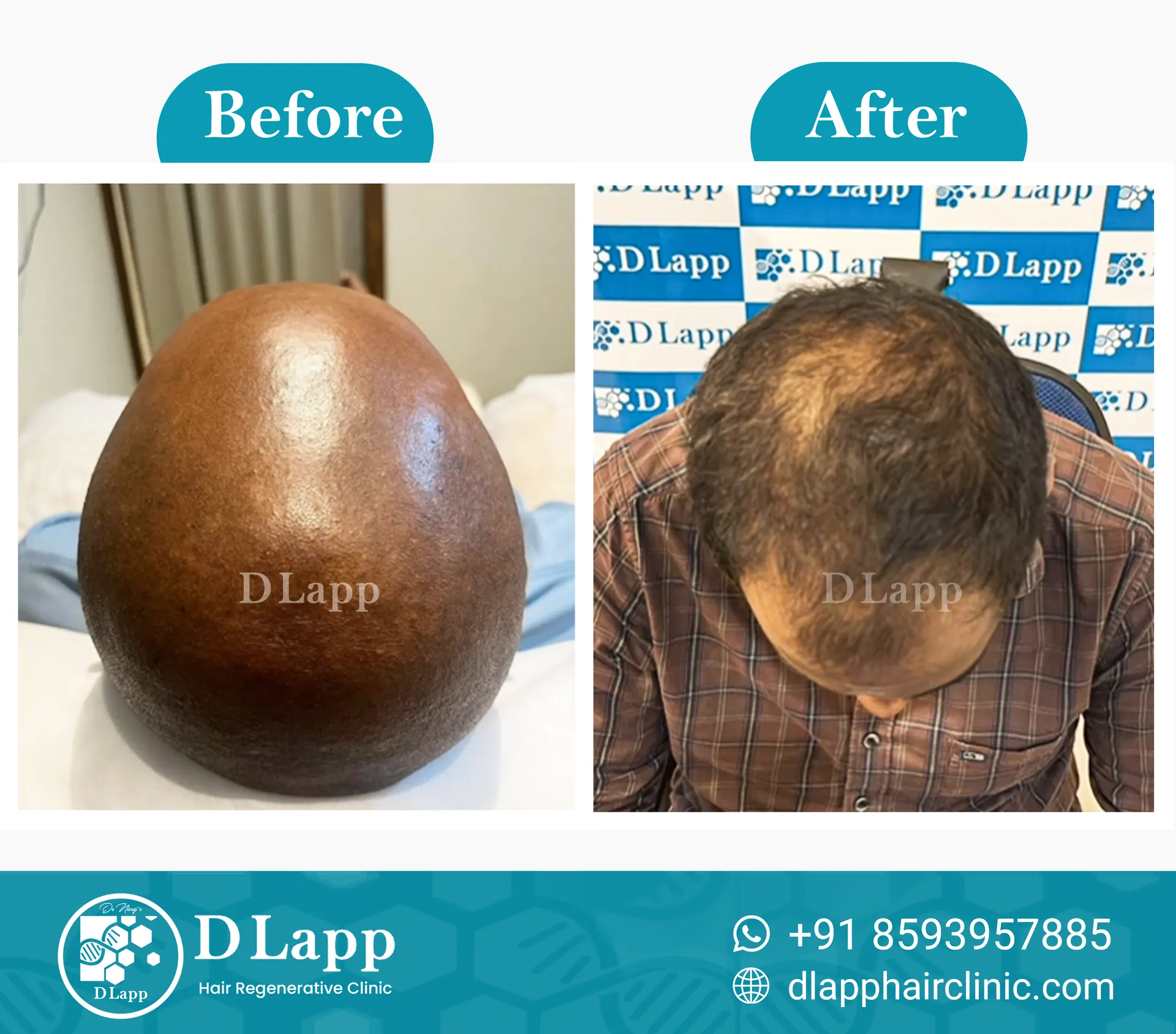 Before/After Medical Image