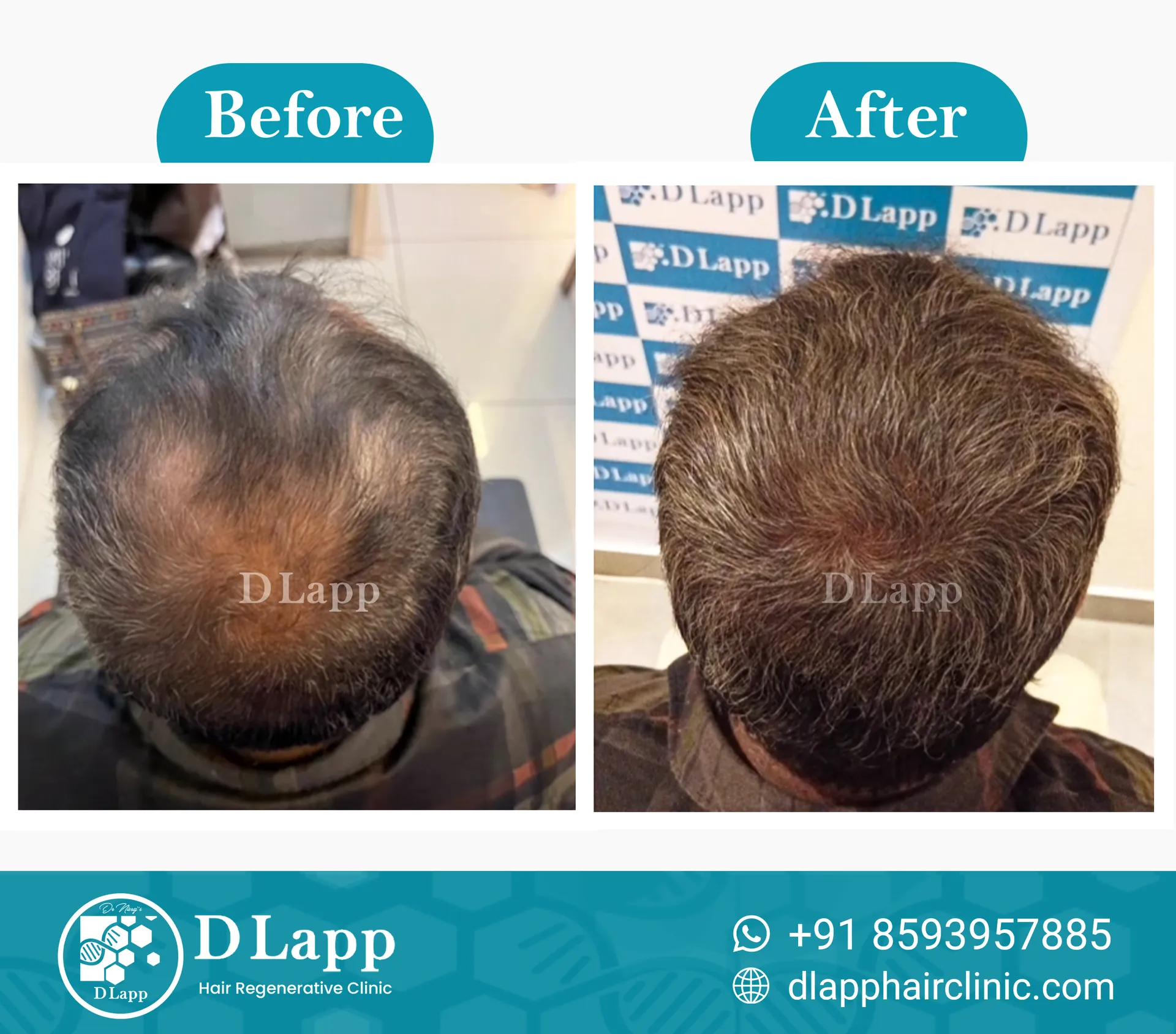 Before/After Medical Image