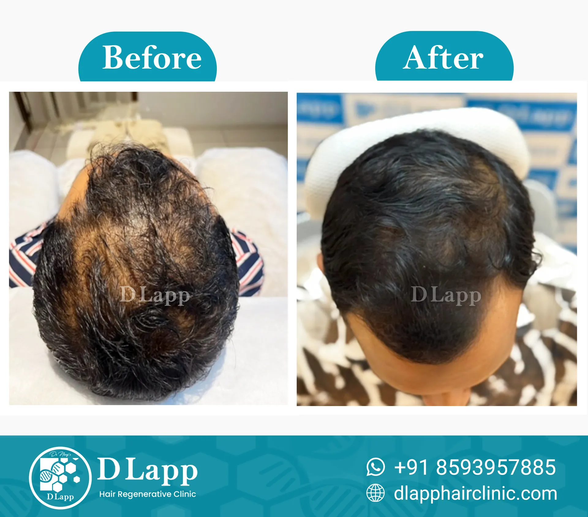 Before/After Medical Image