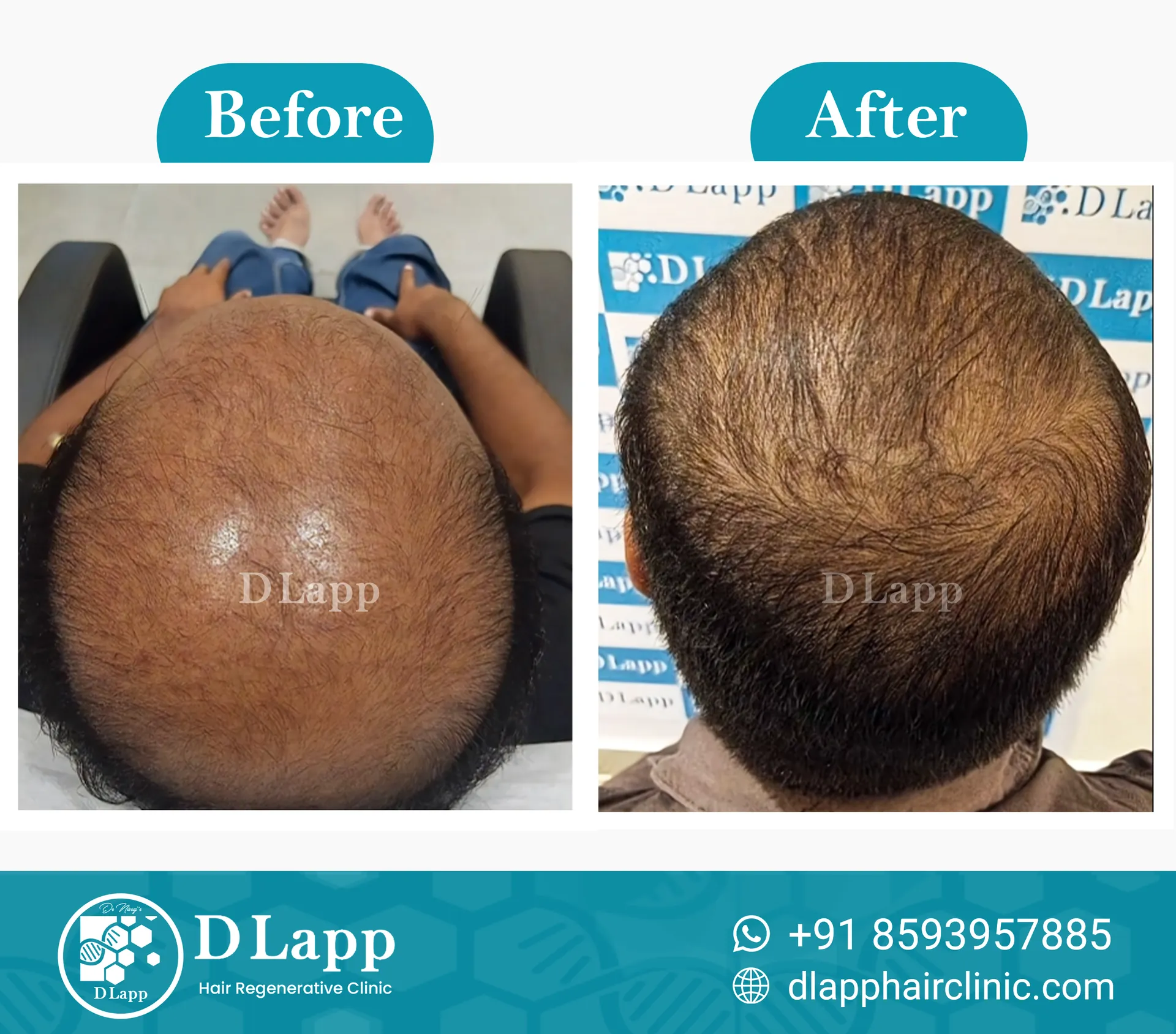 Before/After Medical Image