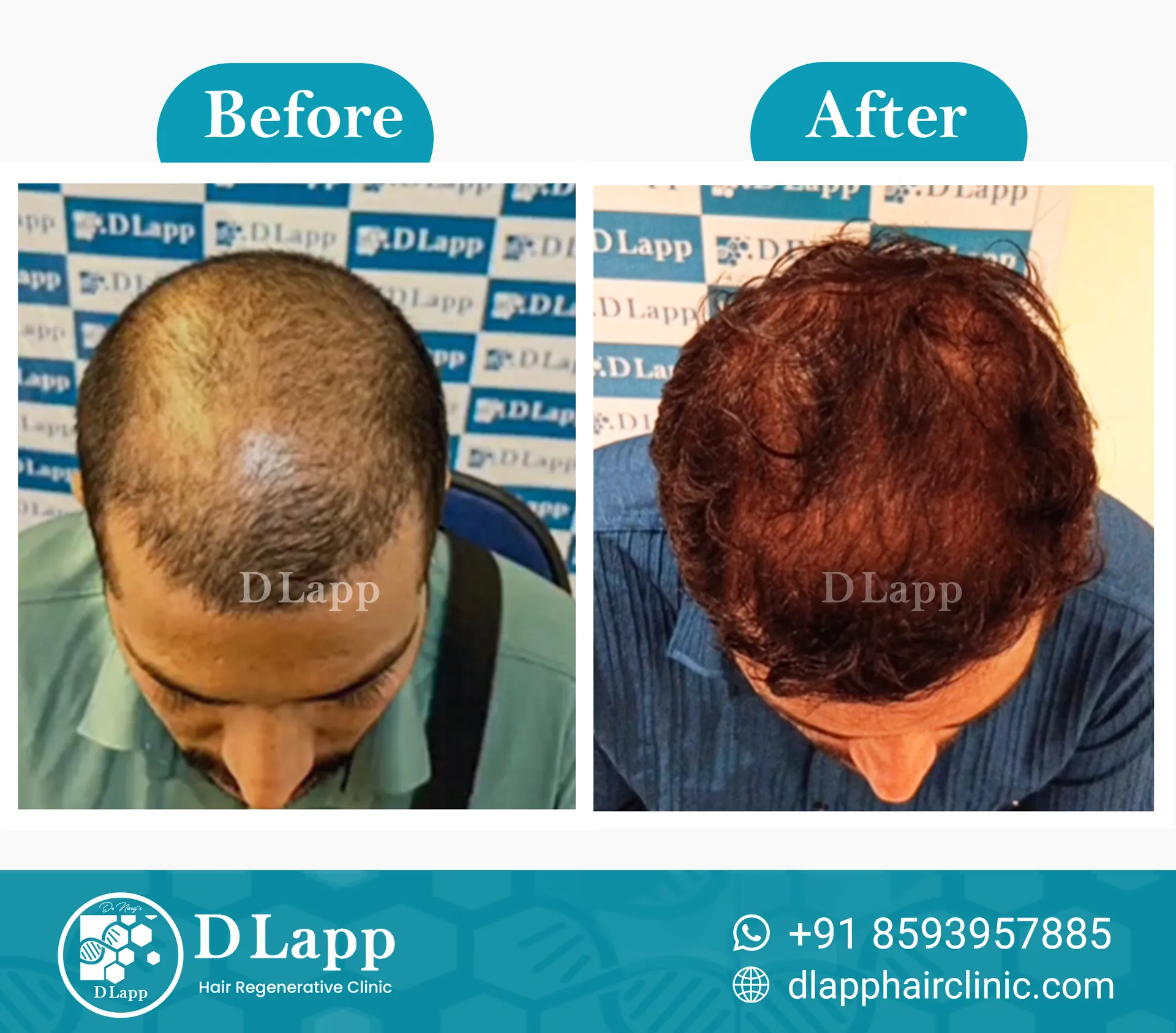 Before/After Medical Image