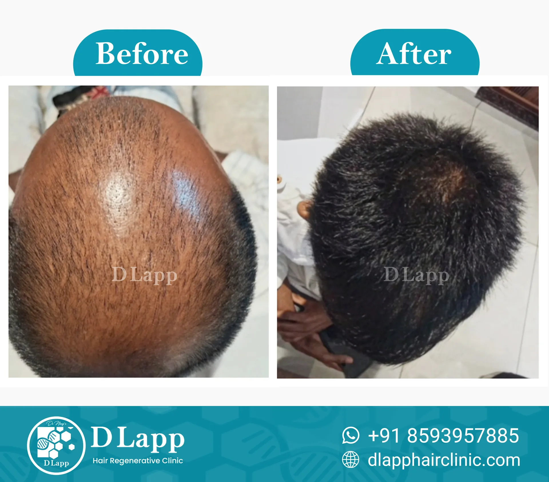 Before/After Medical Image