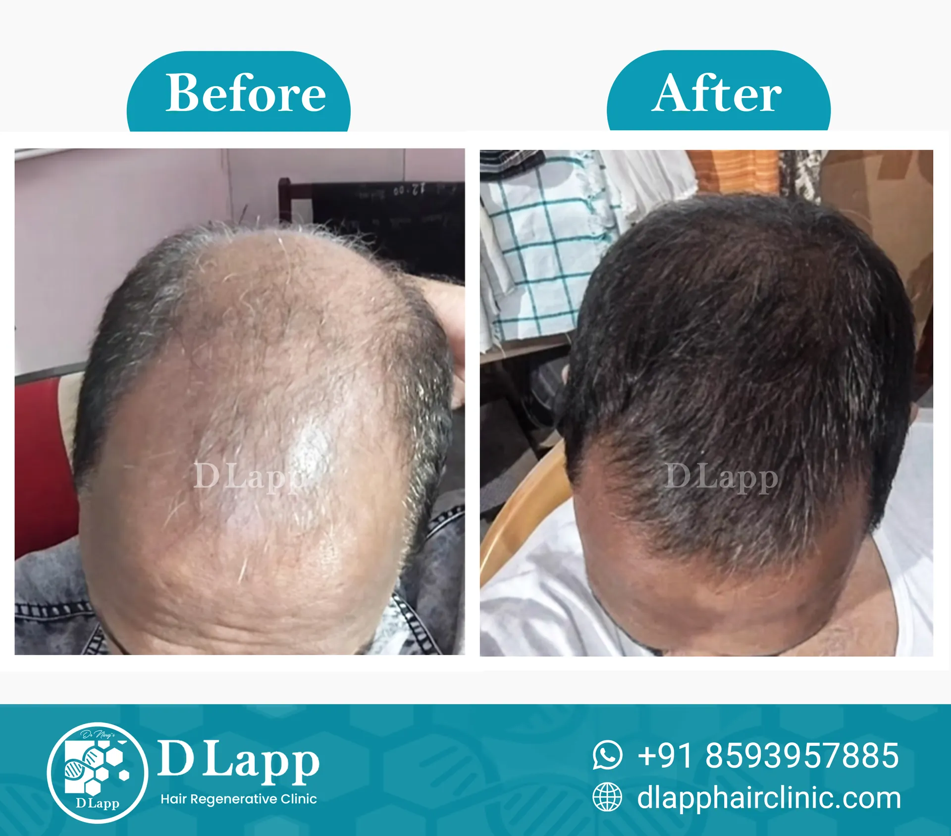 Before/After Medical Image