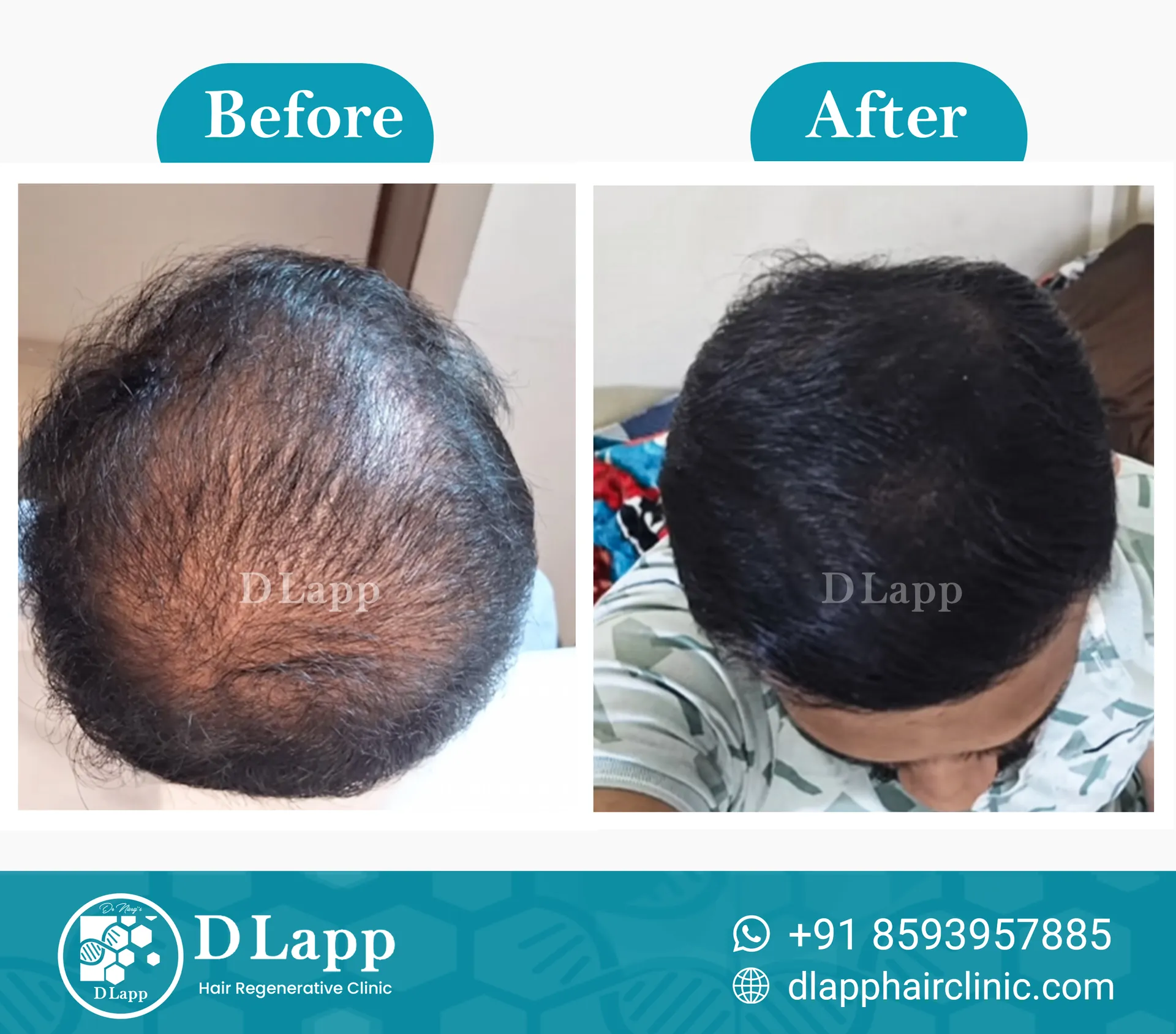 Before/After Medical Image