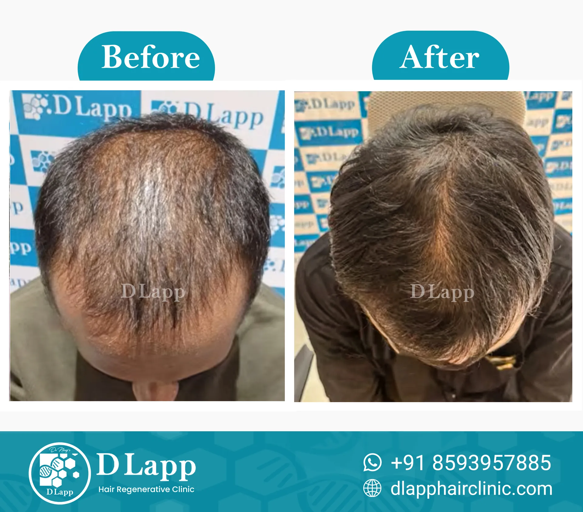 Before/After Medical Image